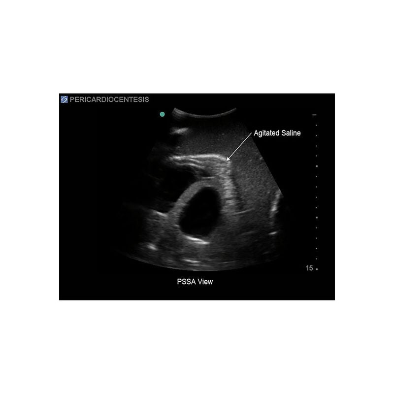 FAST Exam Ultrasound Training Model - Transthoracic & Transesophageal Echo Simulator for Cardiac Sonography Practice (Ideal for Medical Students, Ultrasound Tech Training & Clinical Skills Development)