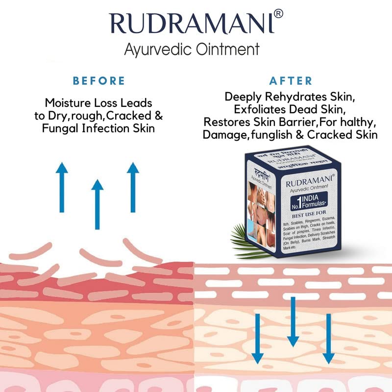 RUDRAMANI Ayurvedic Foot Cream for Dry Cracked Heels - Natural Heel Repair with Moisturizing Benefits - 25g (Pack of 2) - Perfect for Dry Skin Care & Cracked Heel Treatment at Home