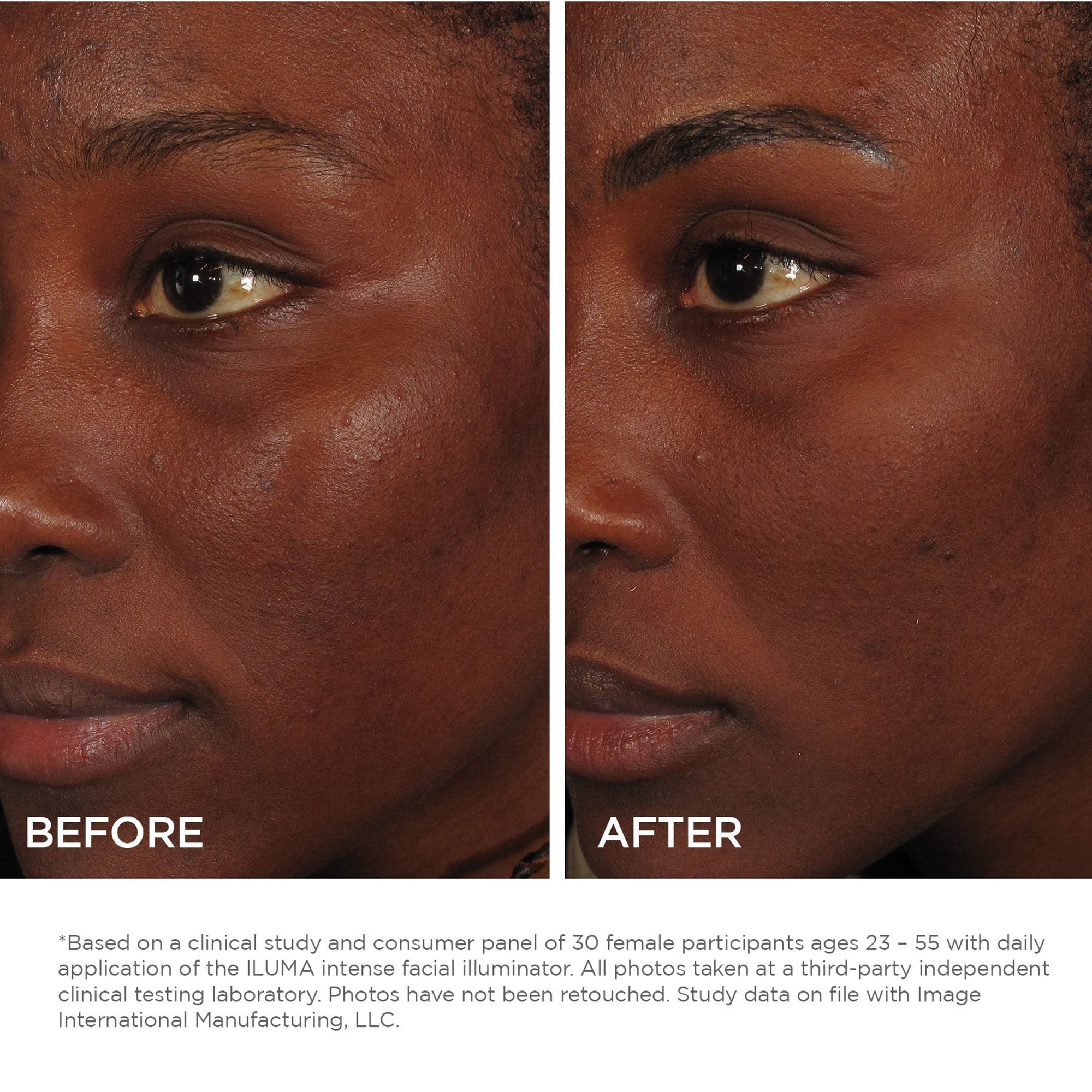 Image Skincare Iluma Brightening Intense Facial Illuminator - Skin Brightening Serum for Dark Spots & Uneven Tone - Perfect for Nighttime Routine & Special Occasion Glow