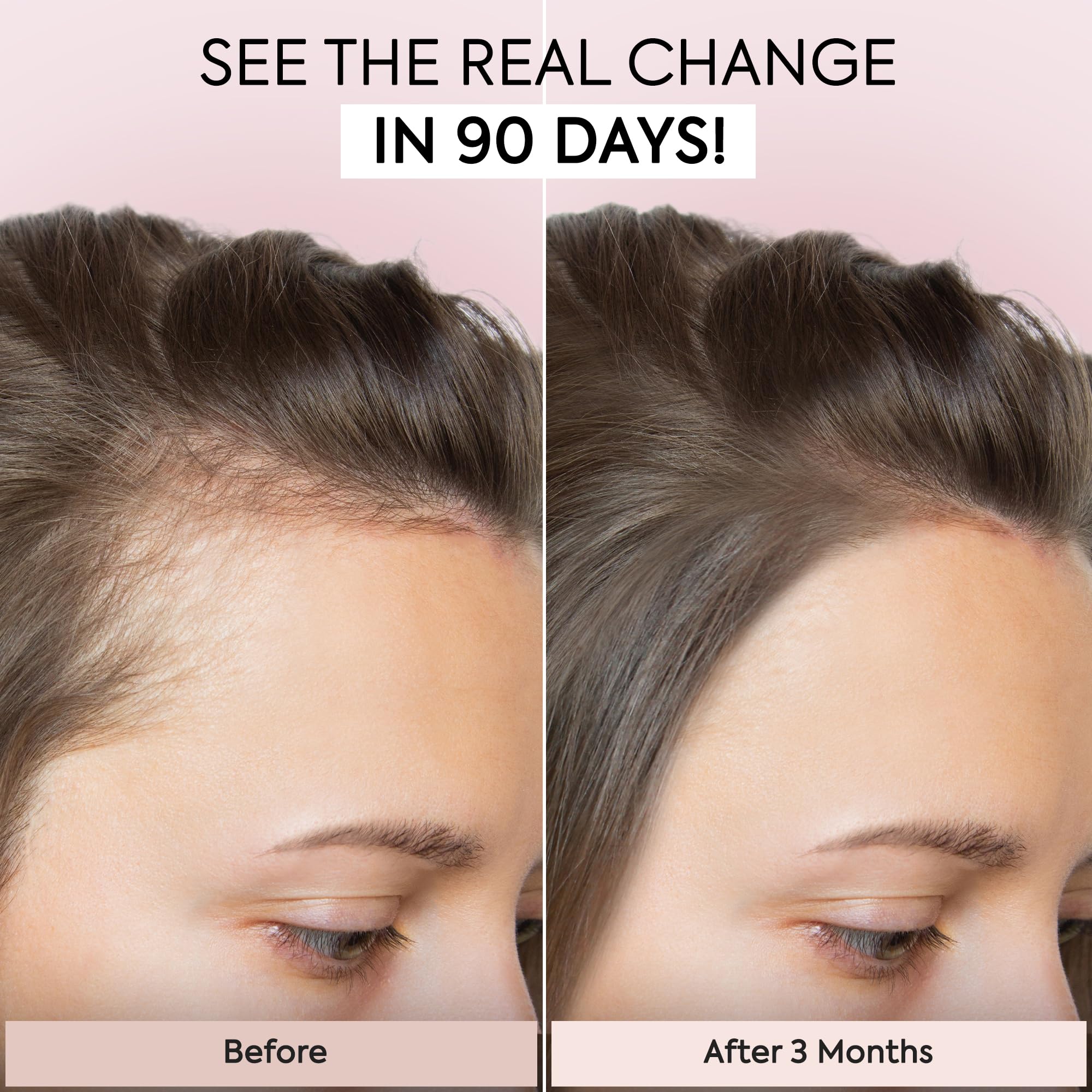 Veganic Natural Hair Growth Serum for Women & Men - Organic Hair Loss Treatment Oil for Thinning Hair - Promotes Fuller, Thicker & Healthier Hair in 90 Days (1 Fl Oz) - Perfect for Daily Scalp Massage & Nighttime Hair Care Routine