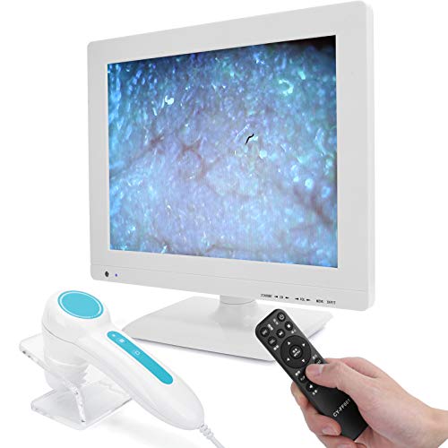 Professional Hair Follicle Tester & Scalp Analyzer - 100-240V Digital Hair Root Microscope for Dry Hair Care & Scalp Health (UK Certified) - Perfect for Salon Treatments & Home Hair Care Routine