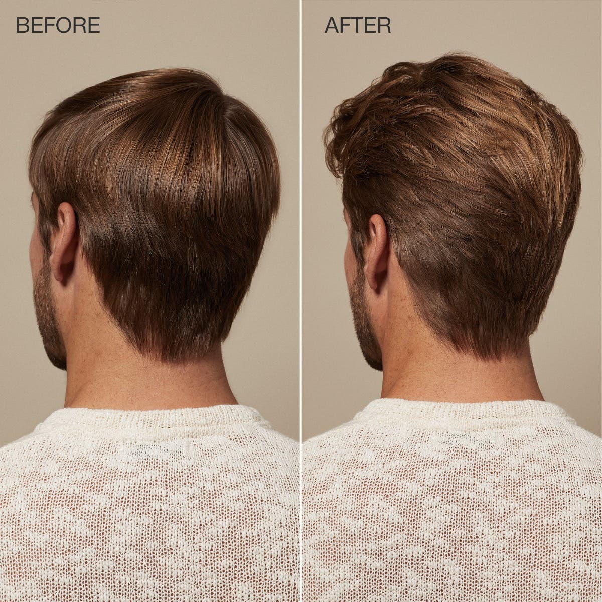 Regeniplex Scalp Care Tonic for Hair Growth & Scalp Health - Stimulates Hair Follicles & Reduces Thinning - Ideal for Men & Women with Dry, Itchy Scalp or Hair Loss Concerns