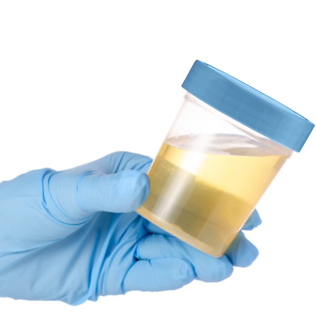 Leak-Proof 4oz Specimen Cups with Screw-On Lids - Pack of 25 Clear Non-Sterile Urine Sample Containers - Ideal for Medical Testing, Home Health Kits & Laboratory Use - Safe Collection for Urine, Stool & Semen Samples