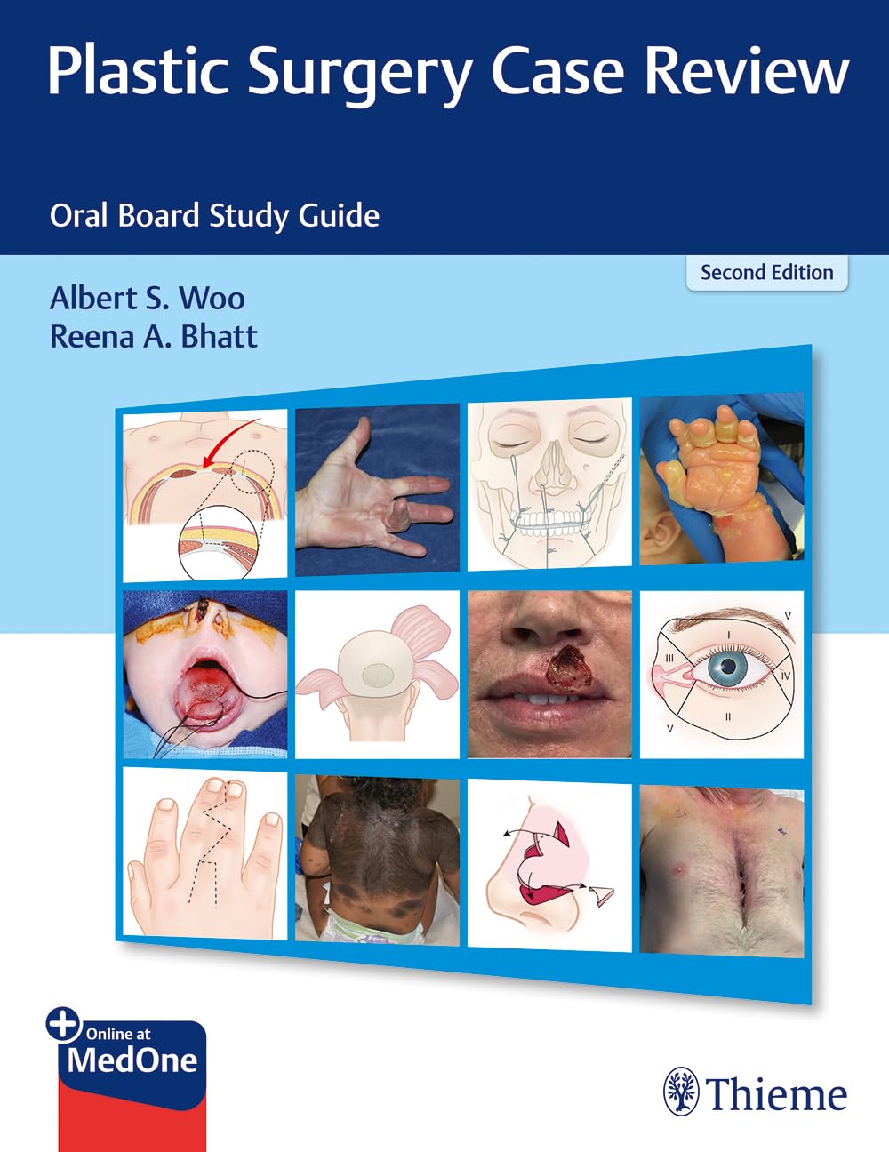 Plastic Surgery Oral Board Review Guide - Comprehensive Case Studies for Exam Prep | Ideal for Residents & Surgeons