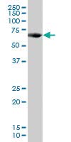 Anti-PCK1 Mouse Polyclonal Antibody (50µG) - High-Quality Research Antibody for Western Blot, Immunohistochemistry & ELISA - Ideal for Diabetes and Metabolic Disease Studies