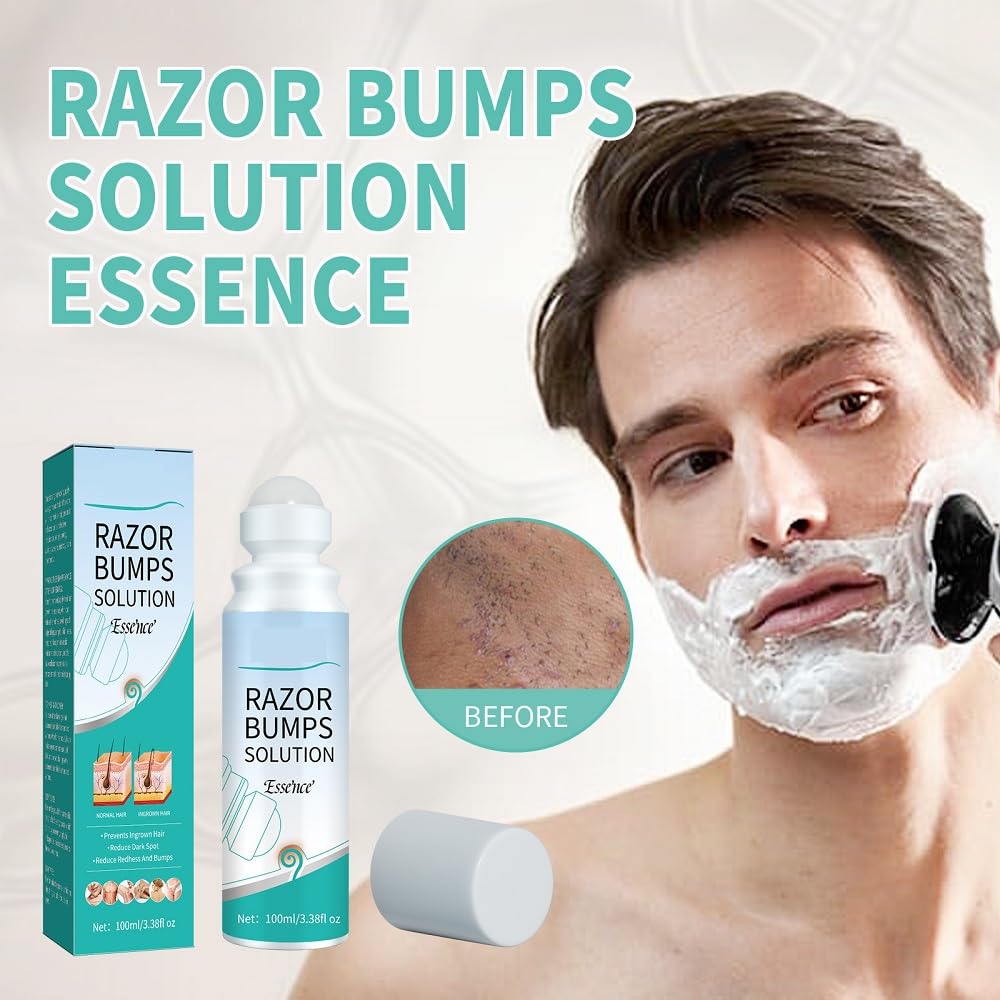 Best Razor Bumps Treatment Solution for Men & Women | Ingrown Hair Prevention | Redness & Itch Relief | Moisturizing Repair Essence | Post-Shave Care for Smooth Skin