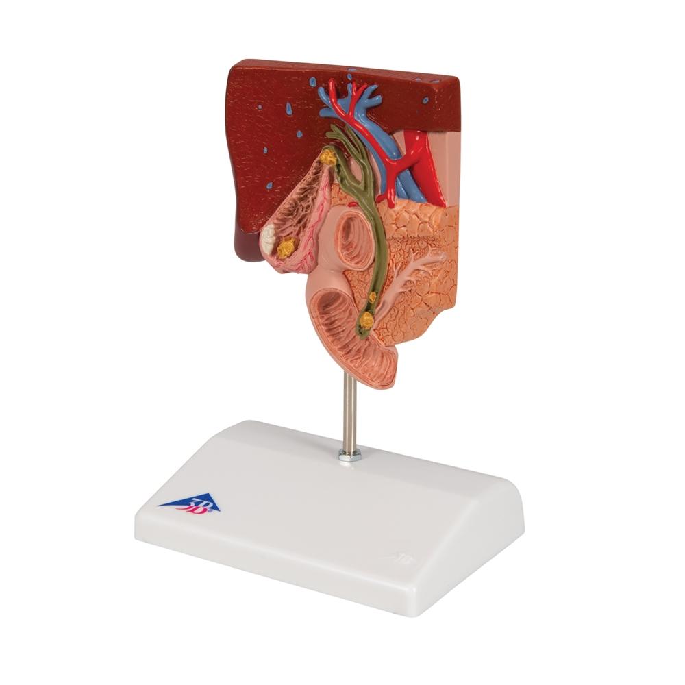 Gallstone Model with 3B Smart Anatomy K26 - Medical Teaching Tool for Human Digestive System Study & Classroom Demonstration