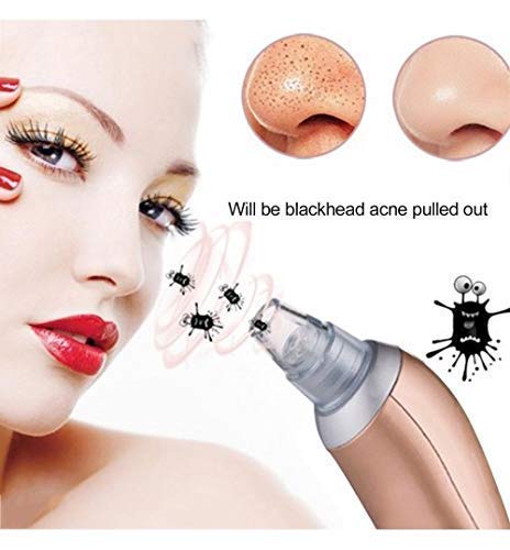 Divik Acne Pore Cleaner Vacuum - Blackhead Remover Kit for Women & Men - Perfect for Daily Facial Care