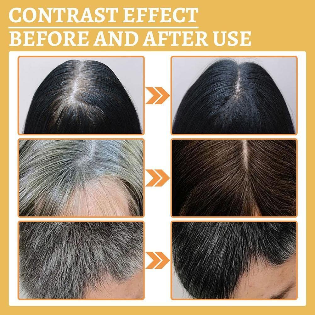 Best Hair Growth Serum Spray for Fast Hair Growth & Hair Loss Prevention - Repair Damaged Hair & Treat Alopecia | For Men & Women, Daily Use at Home or Salon