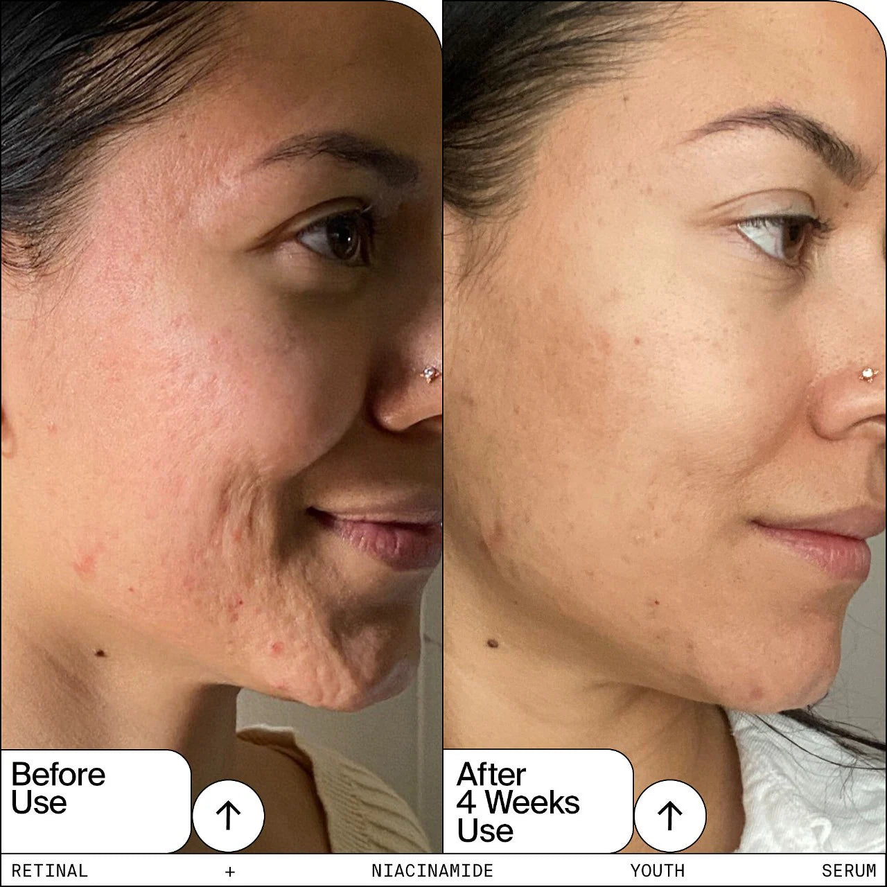 Youth To The People Retinal + Niacinamide Youth Serum 30ml - Anti-Aging Face Serum for Wrinkles & Dark Spots - Vegan & Cruelty-Free Skincare - Perfect for Night Routine & Daily Use