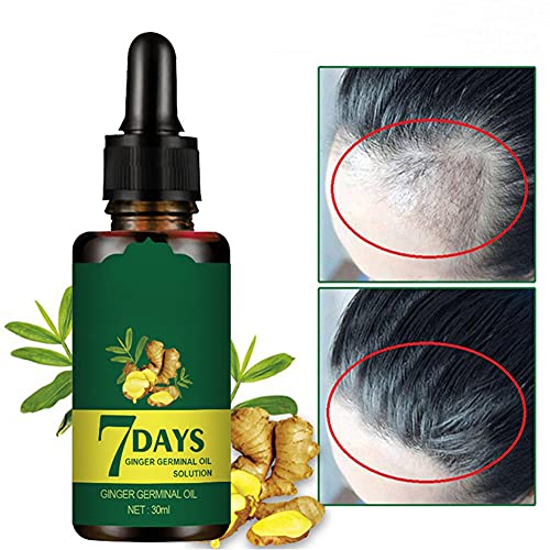 Onkessy Hair Growth Serum with Ginger Oil - Anti Hair Loss Treatment for Thicker, Fuller & Faster Growing Hair - Essential Oil for Hair Regrowth & Scalp Care - Perfect for Daily Use & Hair Thinning Solutions