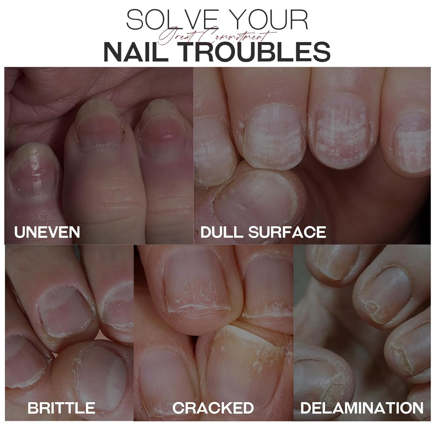 3 in 1 Nail Strengthener & Growth Hardener - Repair Damaged Thin Nails with Quick Dry Base & Top Coat | 0.5 fl oz Nail Care Oil for Stronger, Healthier Nails | Perfect for Manicures, Nail Treatments & At-Home Nail Care