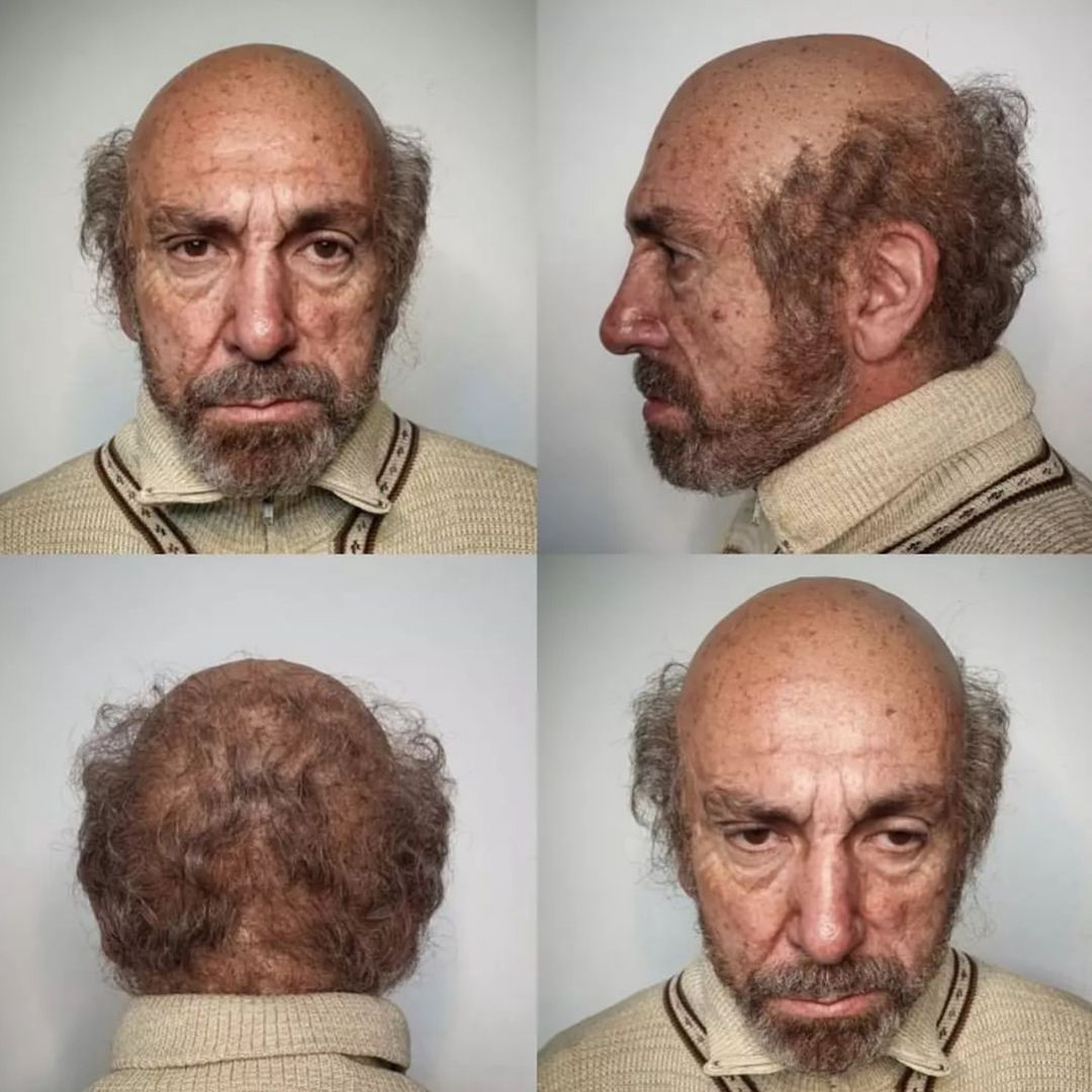 Premium Latex Bald Cap for Prosthetic Makeup - Realistic Bald Head Costume for Halloween, Cosplay, and Theatrical Performances