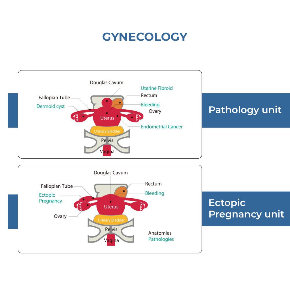 Female Pelvic Ultrasound Phantom for Transvaginal & Transabdominal Training - Gynecology Medical Simulation Model for Sonography Practice & Clinical Skills Development