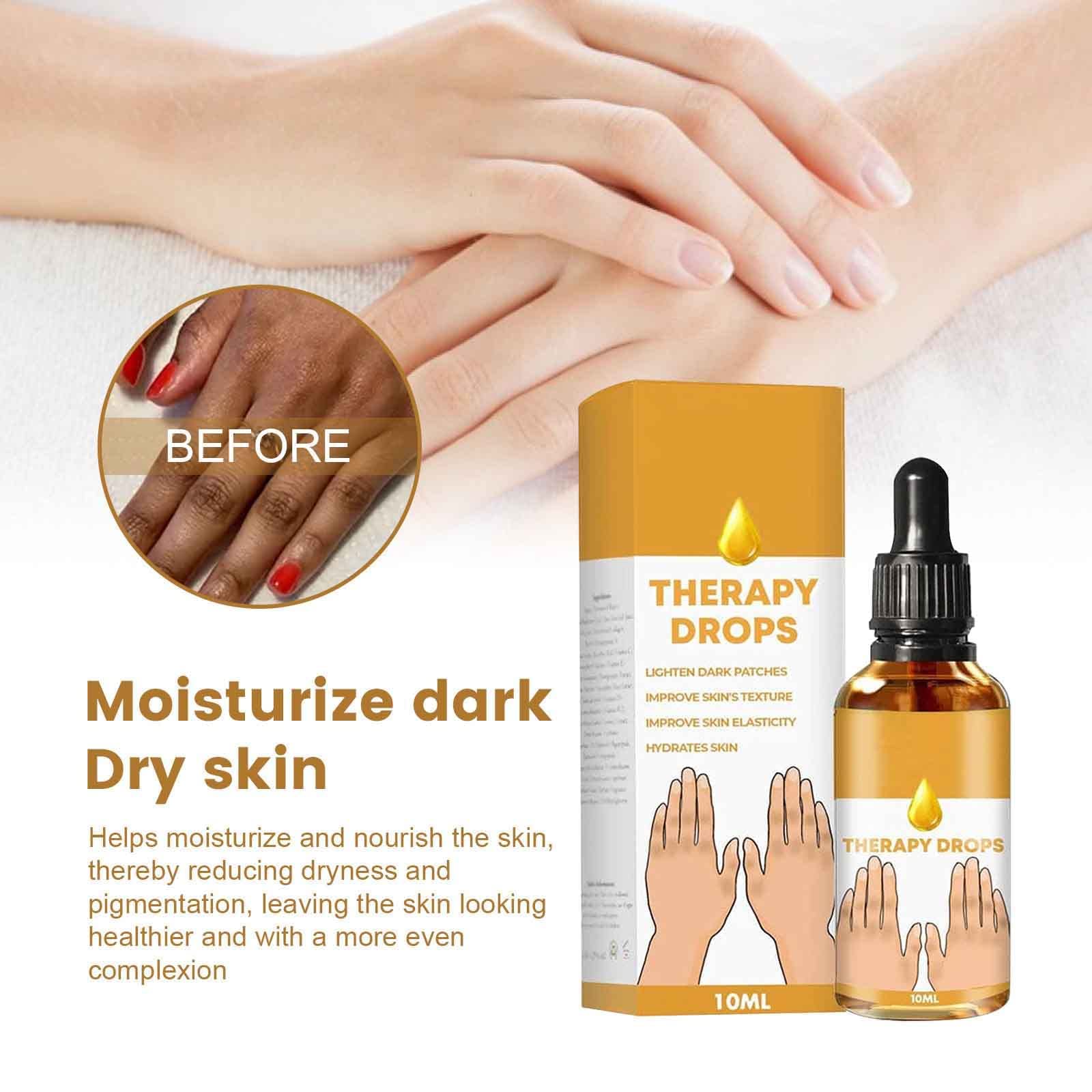 3Pcs Acanthosis Nigricans Therapy Oil - 10ml Nigricare Dark Spot Treatment Drops for Face, Elbows & Knees | Skin Brightening Serum for Hyperpigmentation | Perfect for Nighttime Skincare & Body Care Routine