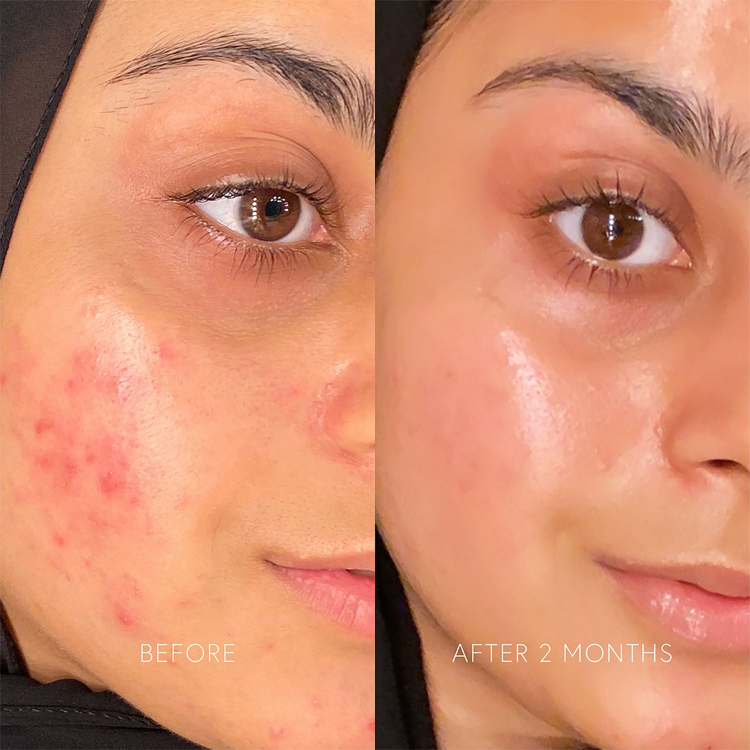 Dr. Barbara Sturm Enzyme Cleanser - Gentle Exfoliating Face Wash for Sensitive Skin | Deep Cleansing & Brightening | Perfect for Daily Skincare Routine & Pre-Makeup Prep