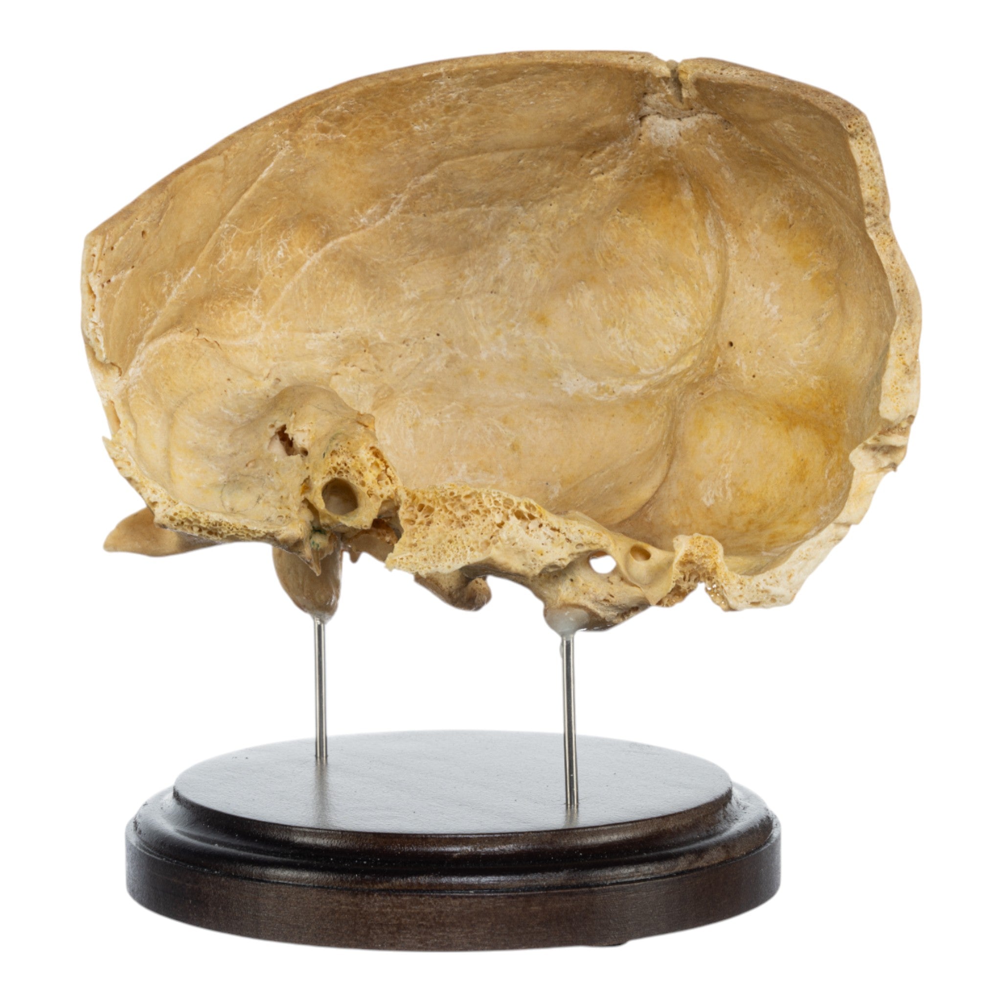 Real Human Partial Skull on Stand - Anatomical Model for Medical Study, Halloween Decor & Gothic Display - Perfect for Doctors, Students & Dark Aesthetic Collectors
