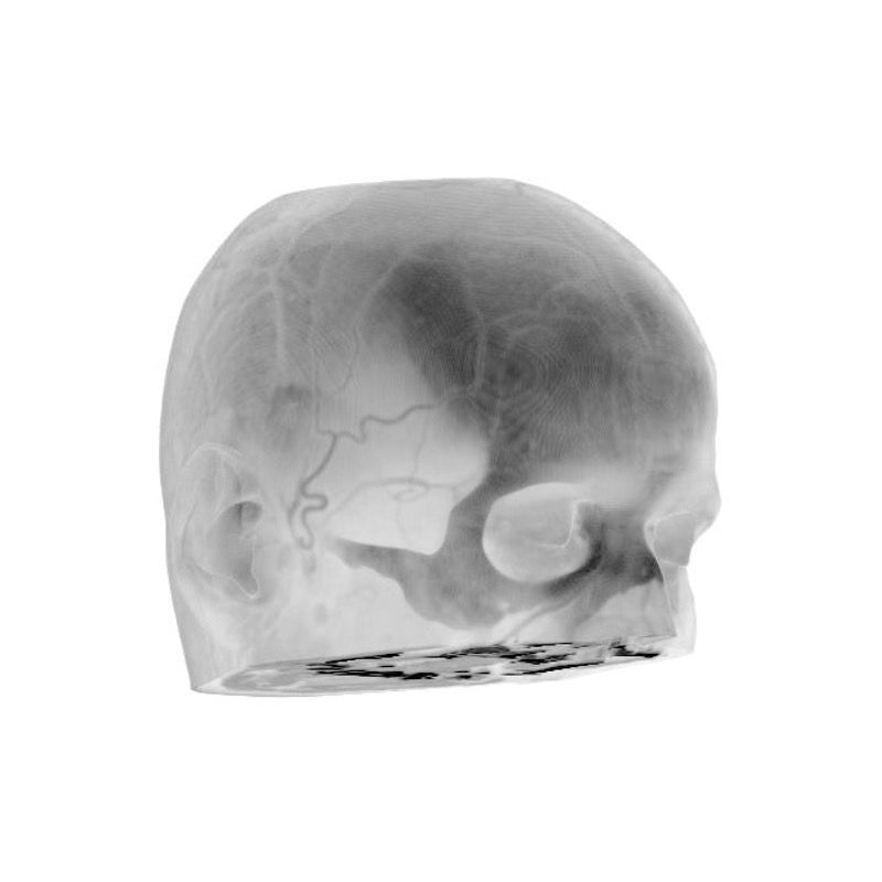 CTA Head Phantom for CT Scan & X-Ray Training - High-Quality Medical Imaging Education Tool for Radiology Students & Technicians