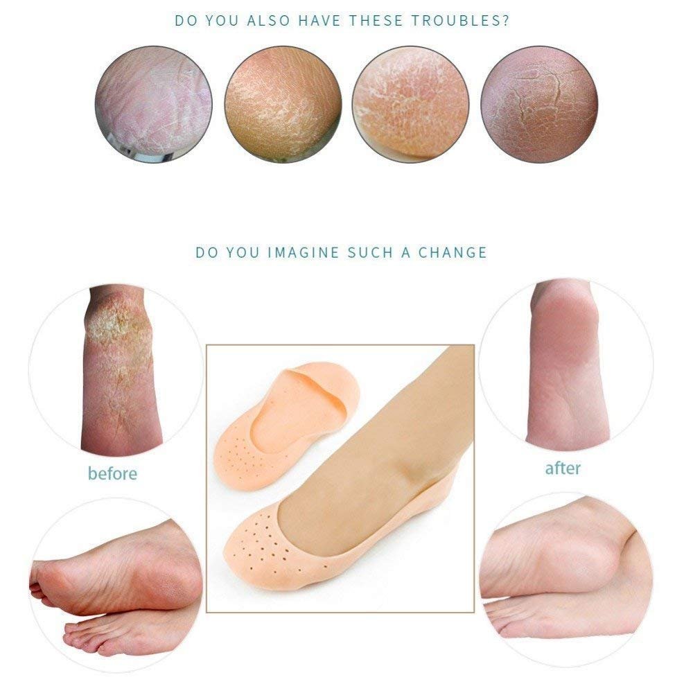 Dweezhet Anti Crack Silicone Foot Protector Socks - Moisturizing Heel Pads for Cracked Feet & Pain Relief - One Size Fits All Men & Women - Perfect for Dry Skin Care, Overnight Treatment & Diabetic Foot Comfort