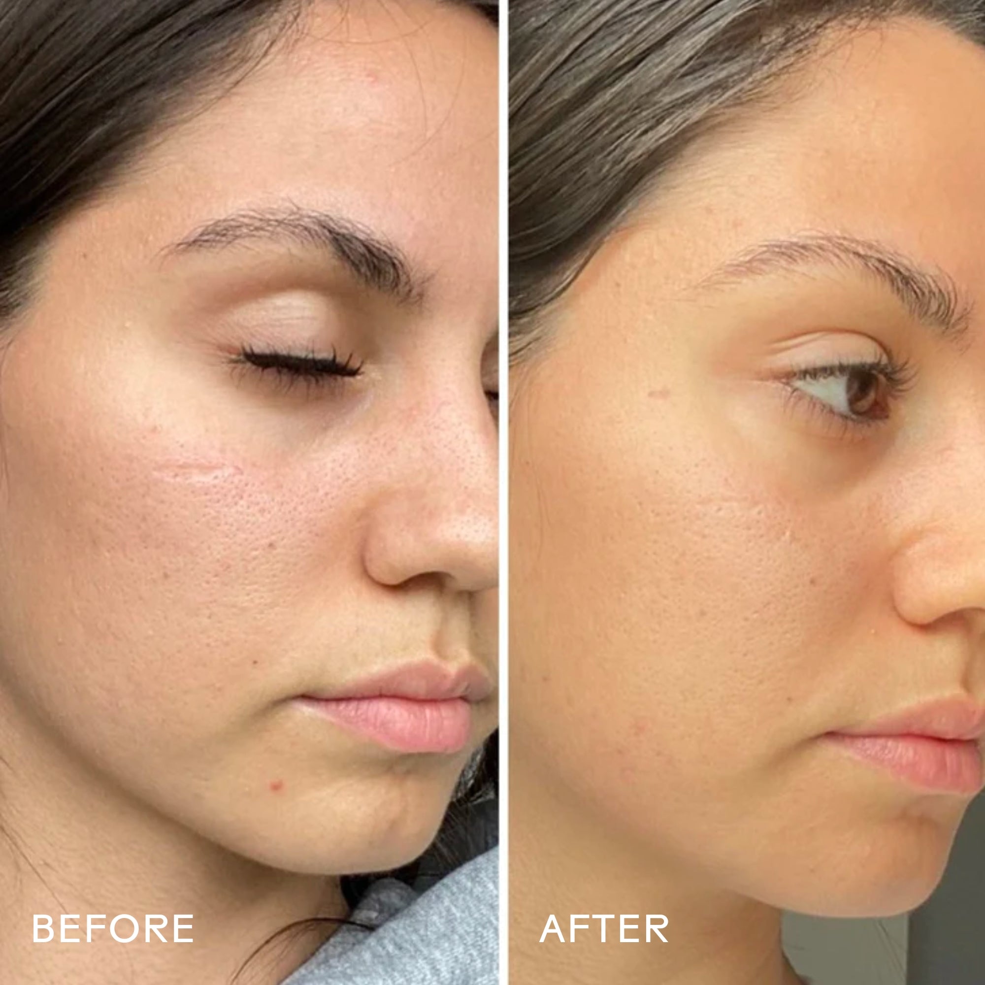 Glow 49% Pure Jojoba Oil Serum for Face & Hair - Hydrating, Nourishing & Anti-Aging Skincare Treatment | Perfect for Dry Skin Care & Hair Growth | Day & Night Use
