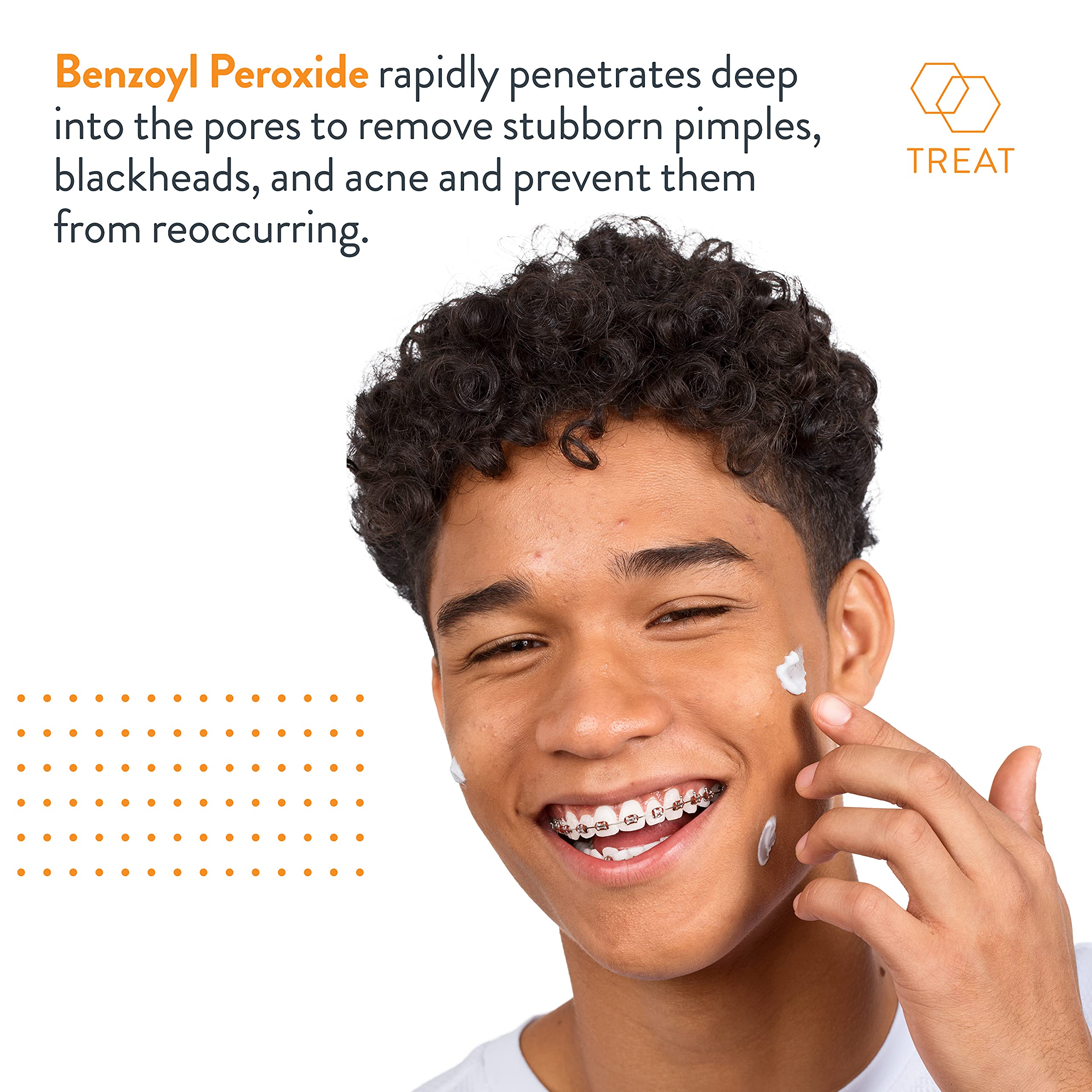 AcneFree Terminator 10 Maximum Strength Acne Spot Treatment with 10% Benzoyl Peroxide - Fast-Acting Acne Cream for Face & Body - 1 Oz (Pack of 2) - Perfect for Teen & Adult Acne, Blemishes & Breakouts