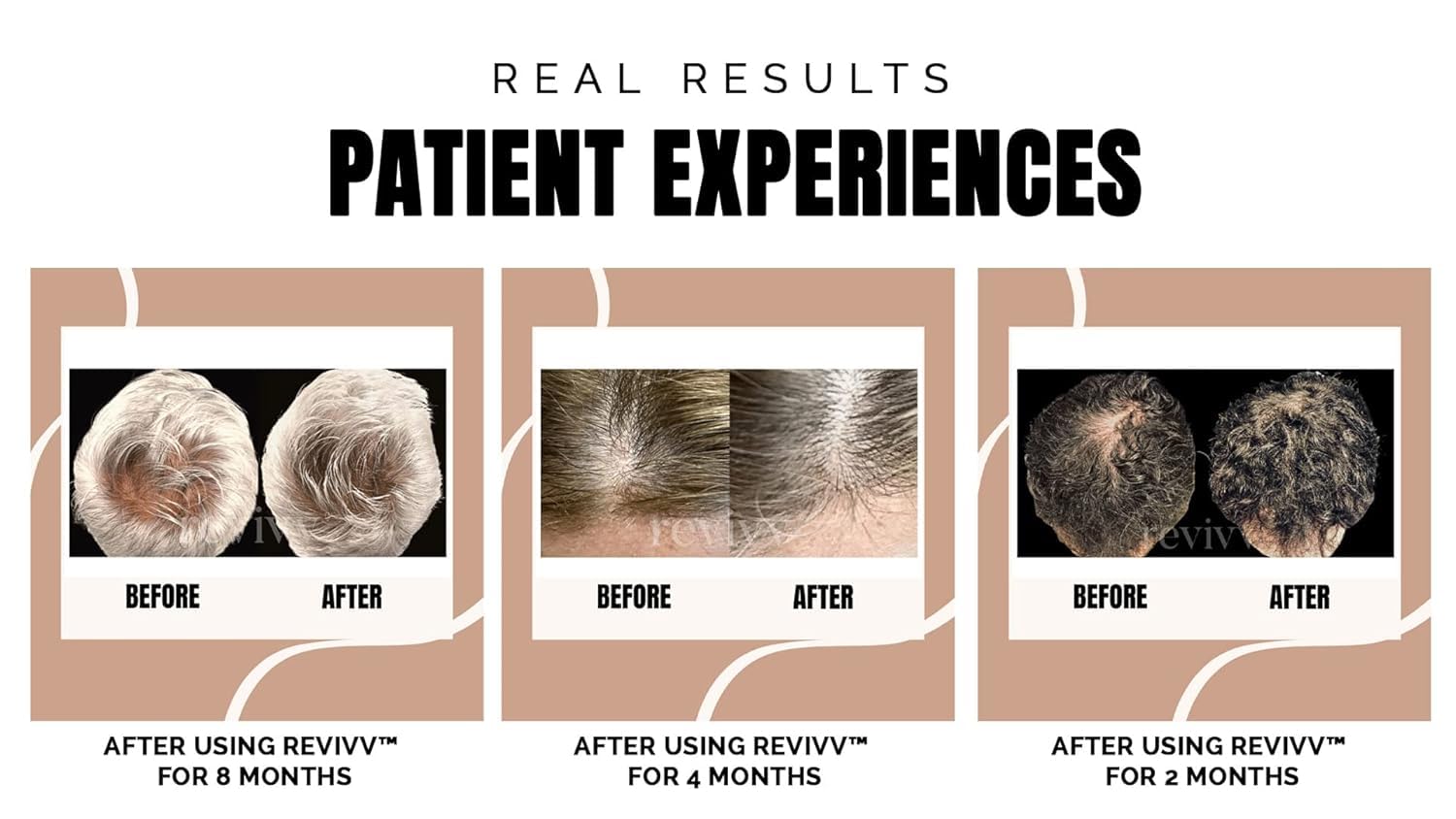 REVIVV Hair Growth Serum for Men - 2-Pack (2 x 1oz) | 100% Natural Topical Solution for Thicker, Fuller Hair Regrowth | Dermatologist Recommended | 90-Day Supply | Perfect for Daily Use & Hair Care Routine