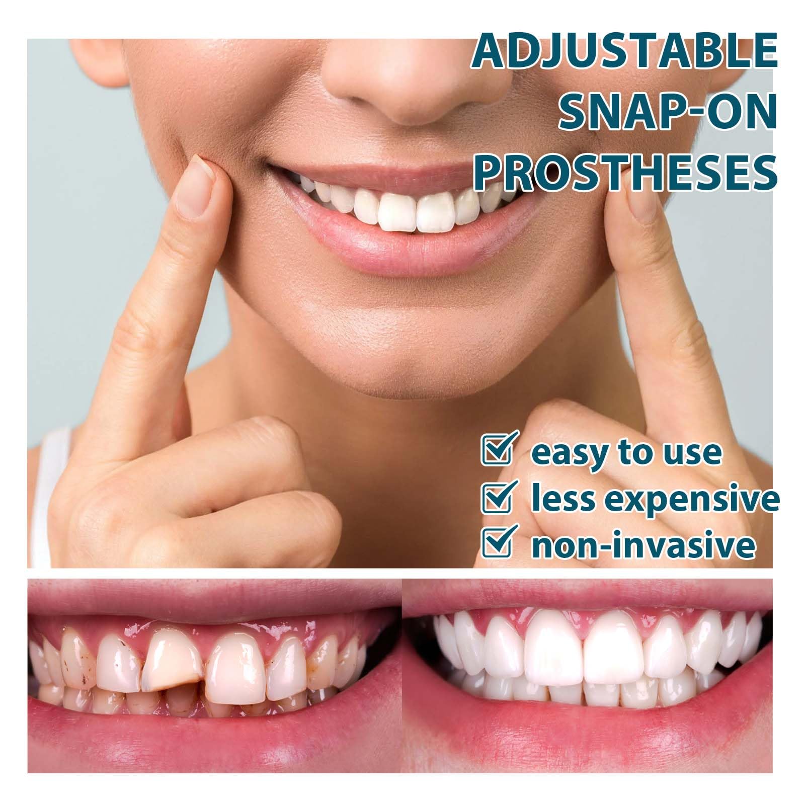 Adjustable Snap-on Dentures Kit - Temporary Teeth Repair & Denture Alignment Solution for Missing Teeth | Perfect for Emergency Dental Care, Travel & Daily Use