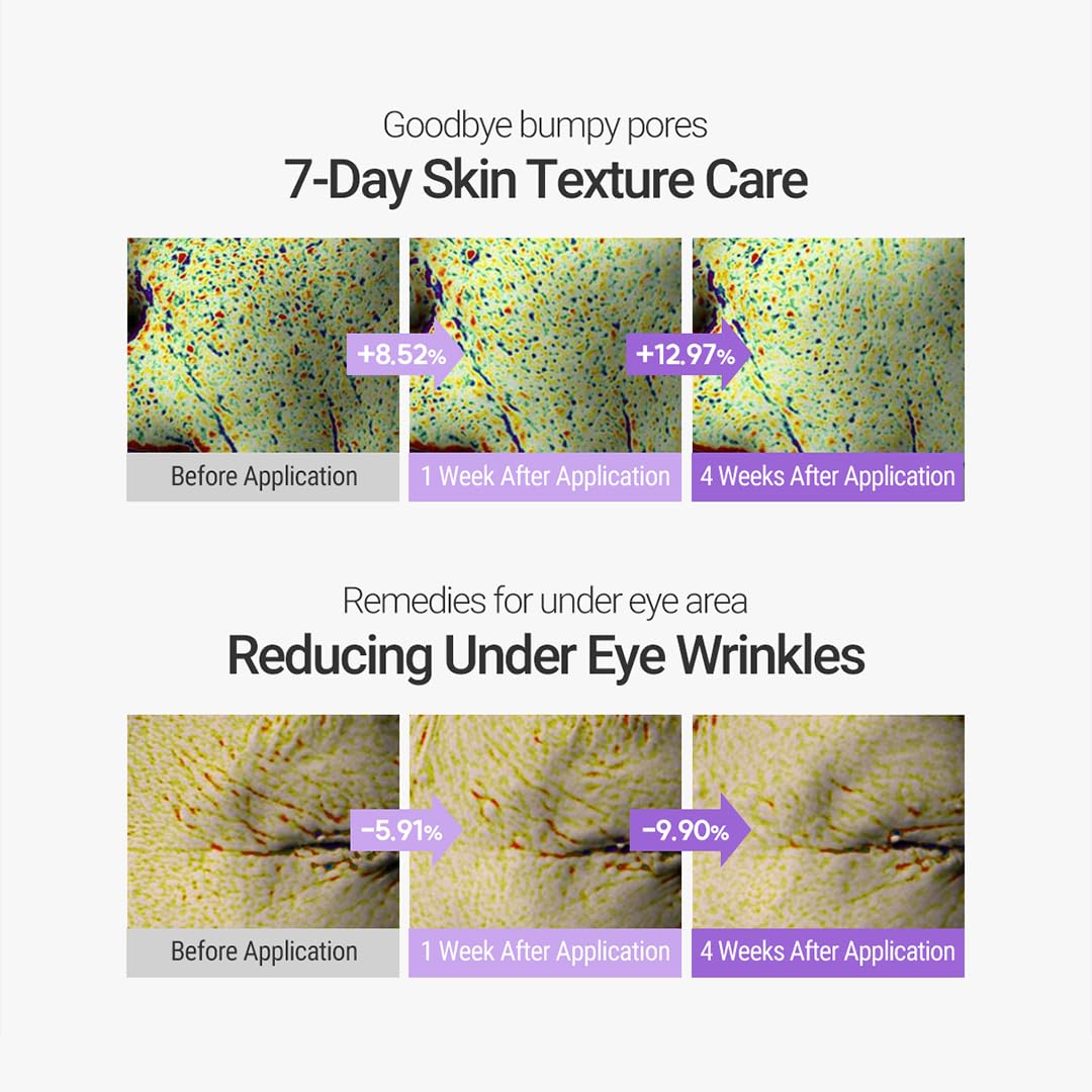 ROVECTIN Retinol Serum 0.15% for Sensitive Skin - Korean Skincare for Anti-Aging & Hydration