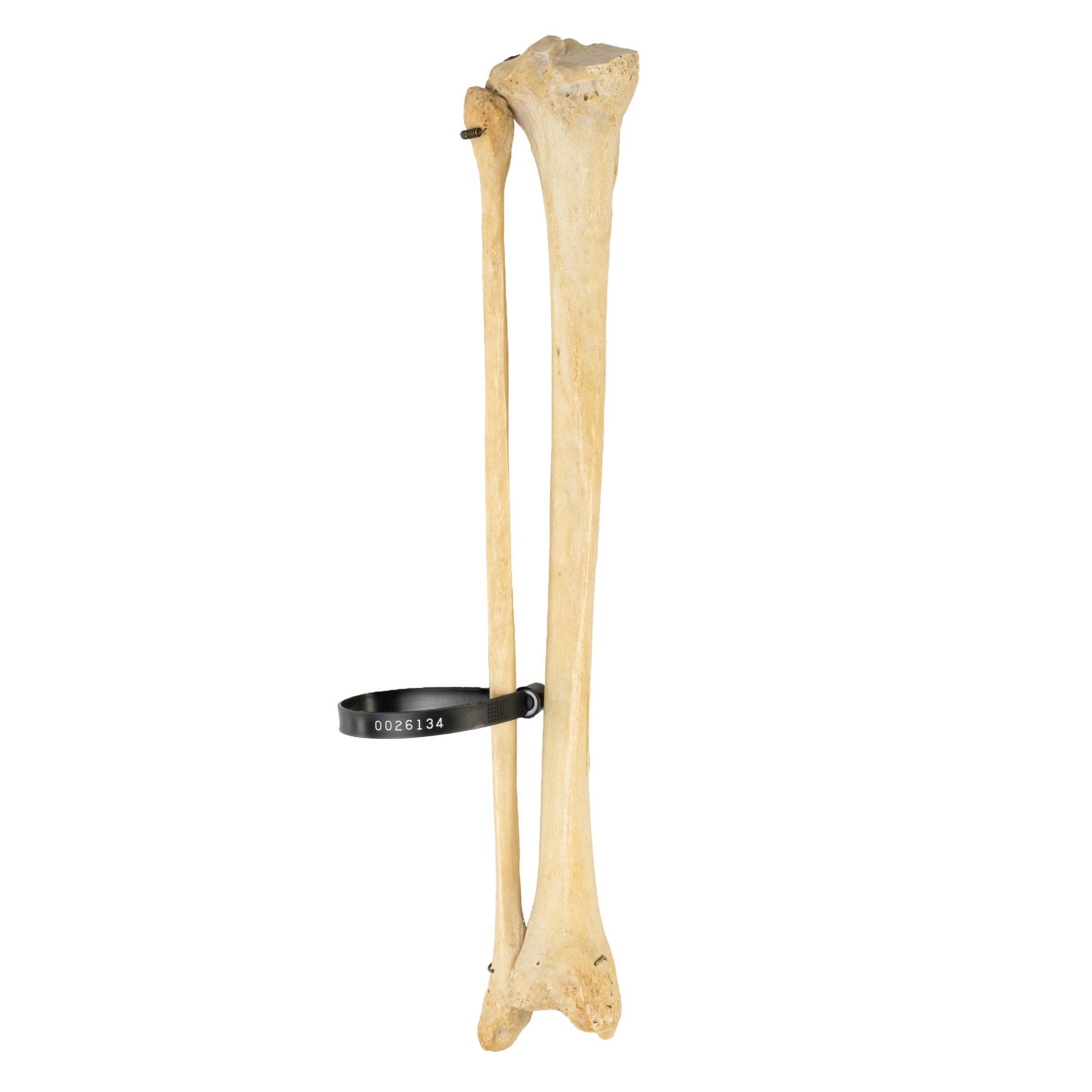Real Human Tibia and Fibula Bones - Authentic Anatomical Specimen for Medical Study, Education & Research