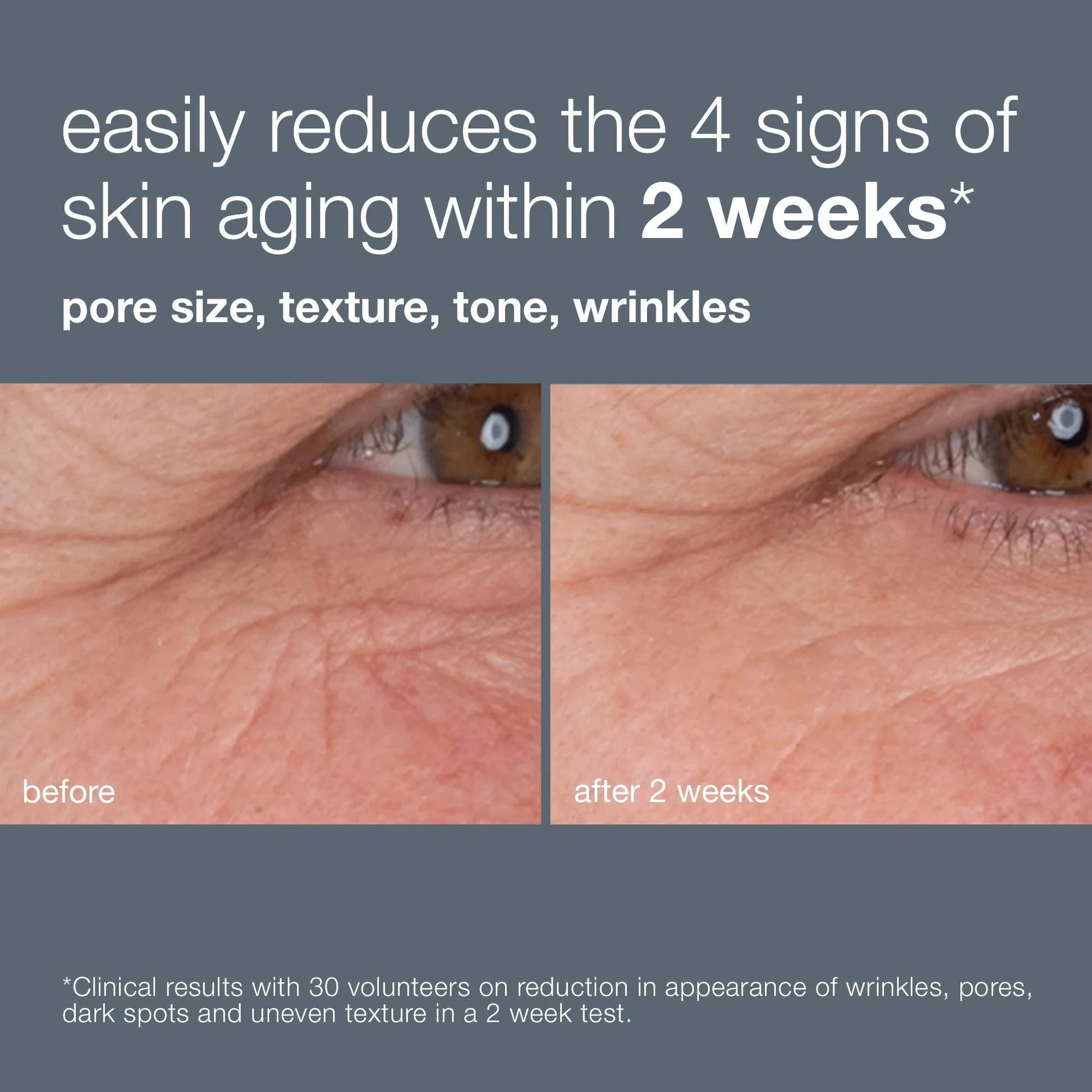 Best Dynamic Skin Retinol Serum for Anti-Aging & Wrinkles - Night Repair Face Treatment for Glowing Skin - Perfect for Dry, Sensitive & Mature Skin Care Routine