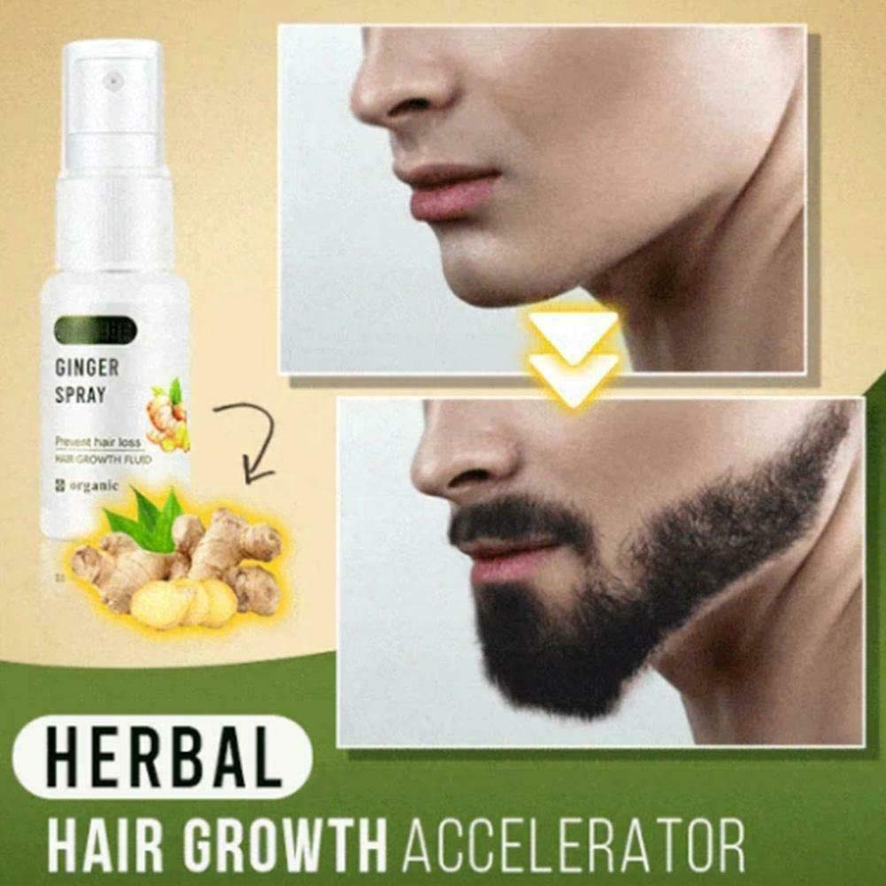 New Biotin & Ginger Hair Growth Serum - Fast Regrowth Treatment with Natural Ingredients for Thicker, Fuller Hair - Perfect for Thinning Hair, Hair Loss & Scalp Care
