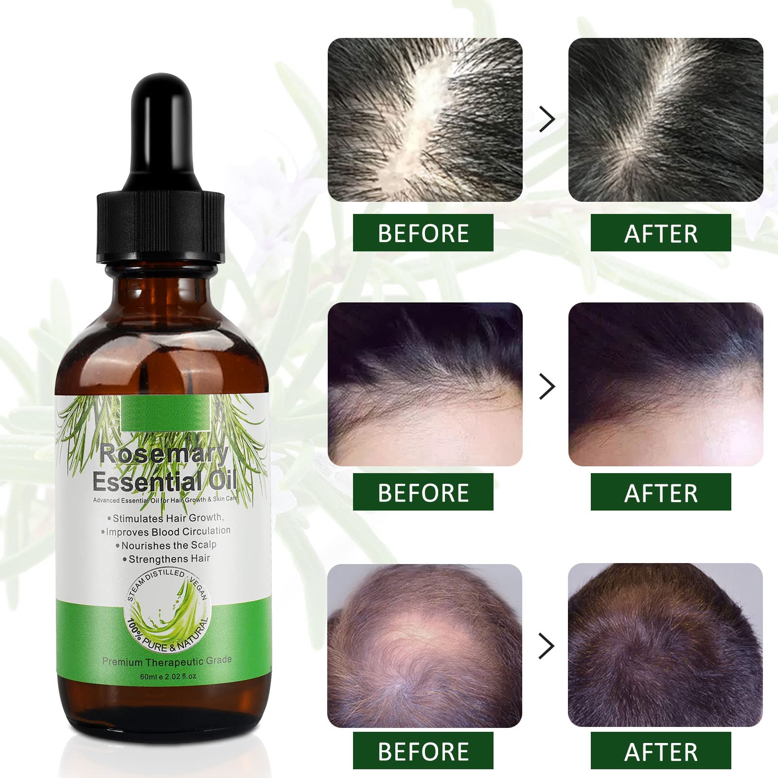 Organic Rosemary Oil for Hair Growth & Skin Care - Natural Hair Strengthening Treatment for Fuller, Healthier Hair - Aromatherapy, Diffuser & Scalp Massage Essential Oil (60ml) - Perfect for Daily Hair Care Routine & Relaxation Therapy