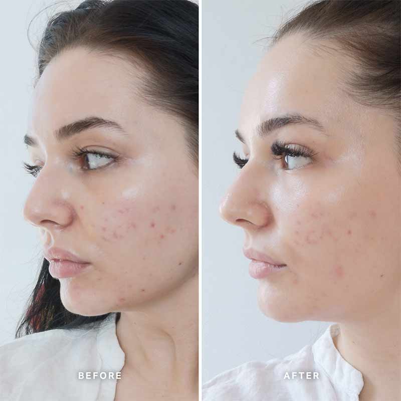 Alpha H Vitamin B Serum with 5% Niacinamide - Brightening & Hydrating Face Serum for Glowing Skin - Perfect for Daily Skincare Routine & Anti-Aging Care