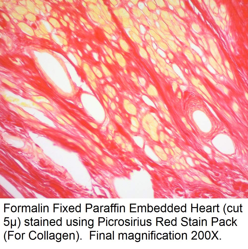 Picrosirius Red Stain Solution 1000ml - High-Quality Collagen Staining for Histology & Pathology Labs