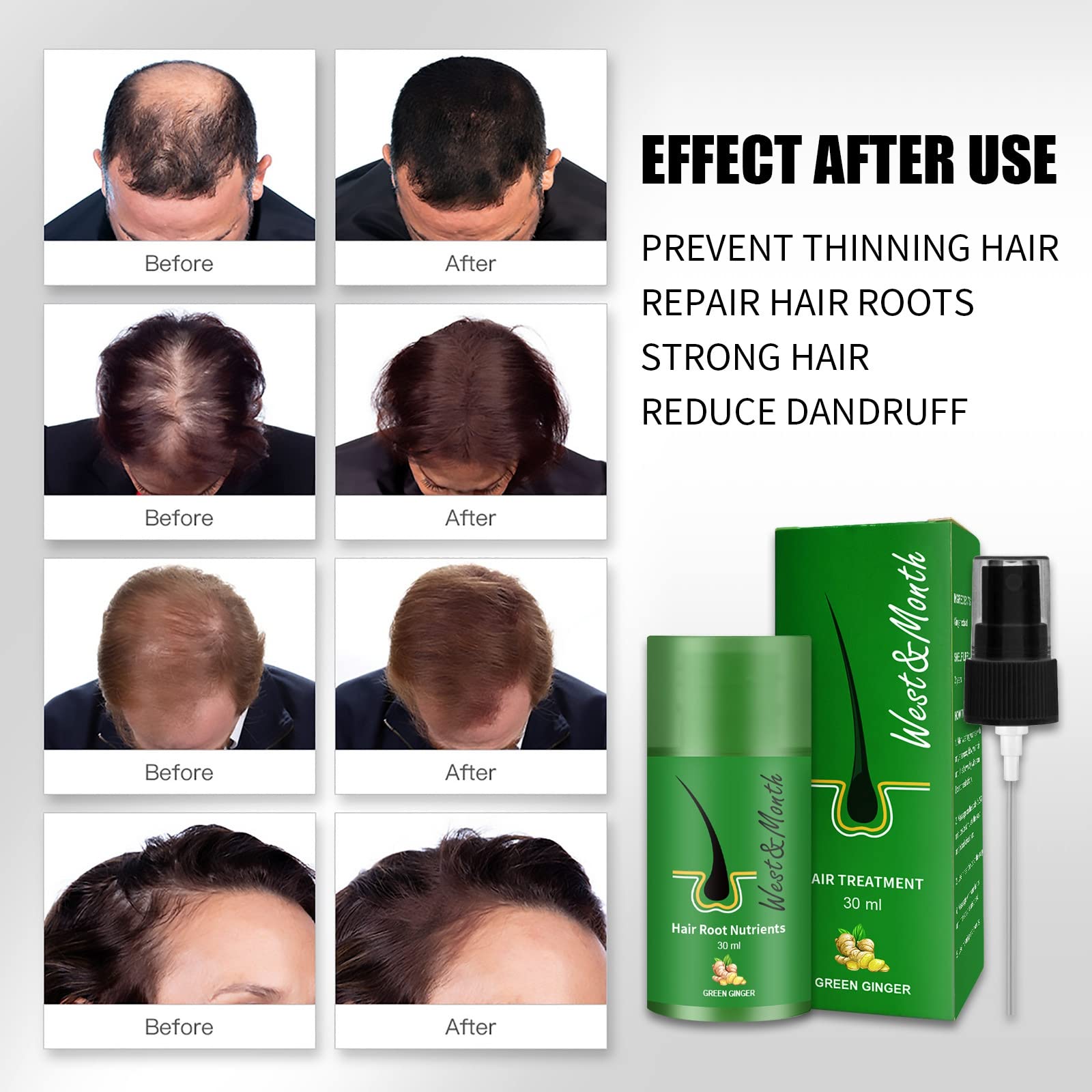 Ginger Hair Regrowth Serum Spray - Natural Hair Growth Treatment for Thicker & Stronger Hair | Prevents Hair Loss & Stimulates Follicles | For Men & Women | Daily Use at Home or Salon (1 Pack)