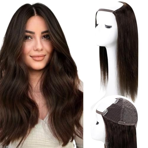 A Wig-2