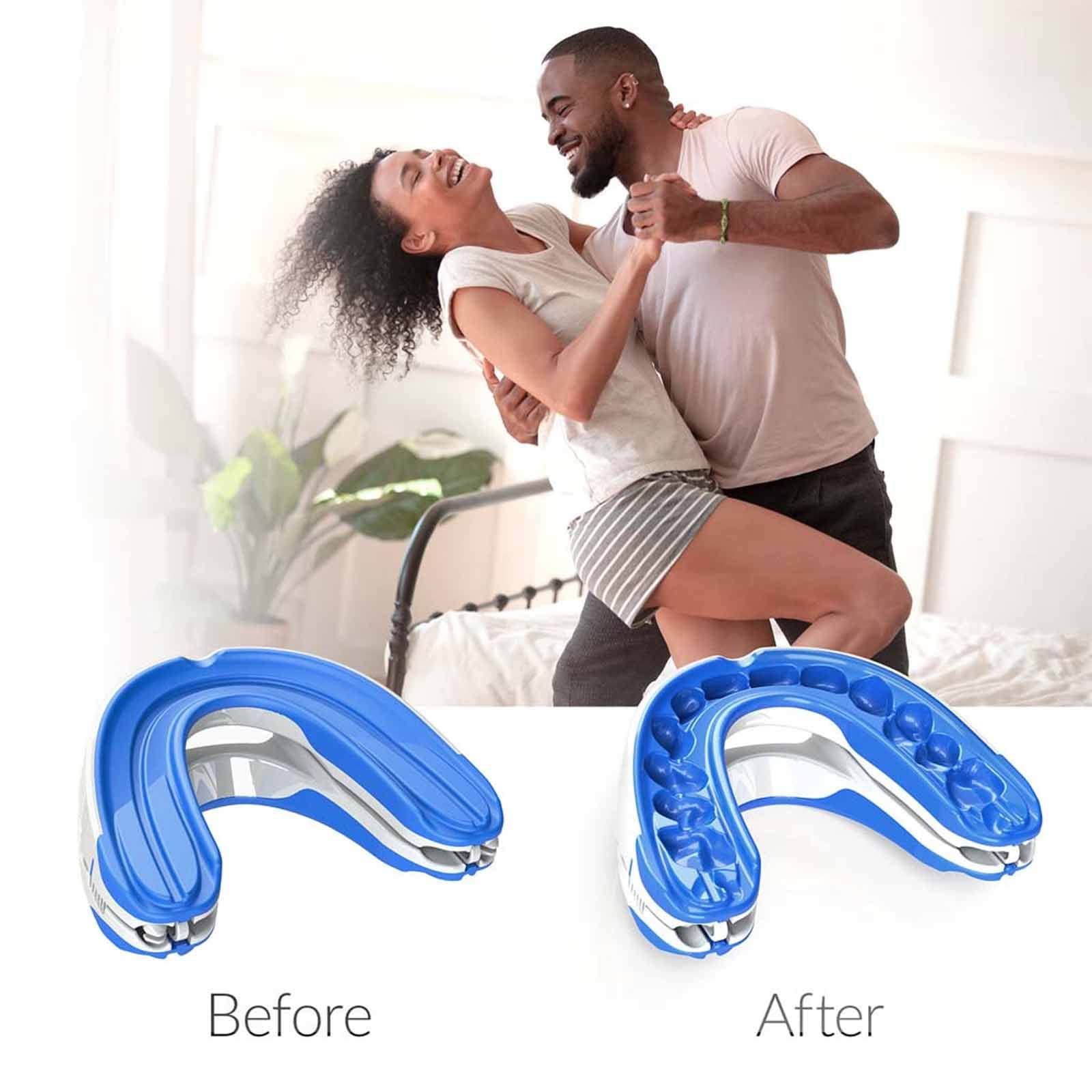 **Wolfmoutiy Anti-Snoring Mouthpiece – Adjustable Jaw Positioning Snore Stopper for Men & Women | Prevents Teeth Grinding & Promotes Natural Sleep | Ideal for Nighttime Use & Travel**