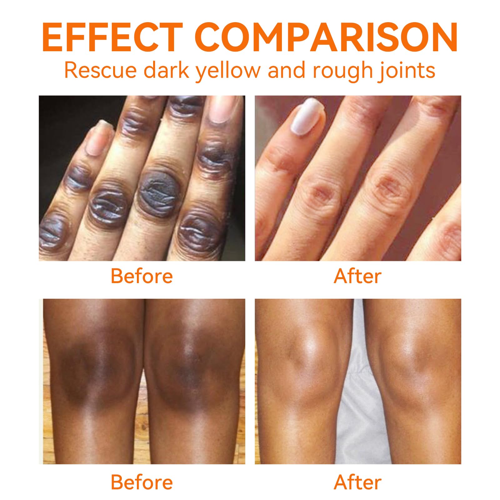 Strong Yellow Peeling Oil for Dark Skin - Extra Strength Chemical Exfoliant for Body, Hands & Feet - Dark Knuckle, Underarm & Toe Brightening Cream - Perfect for At-Home Spa Treatments & Skin Renewal