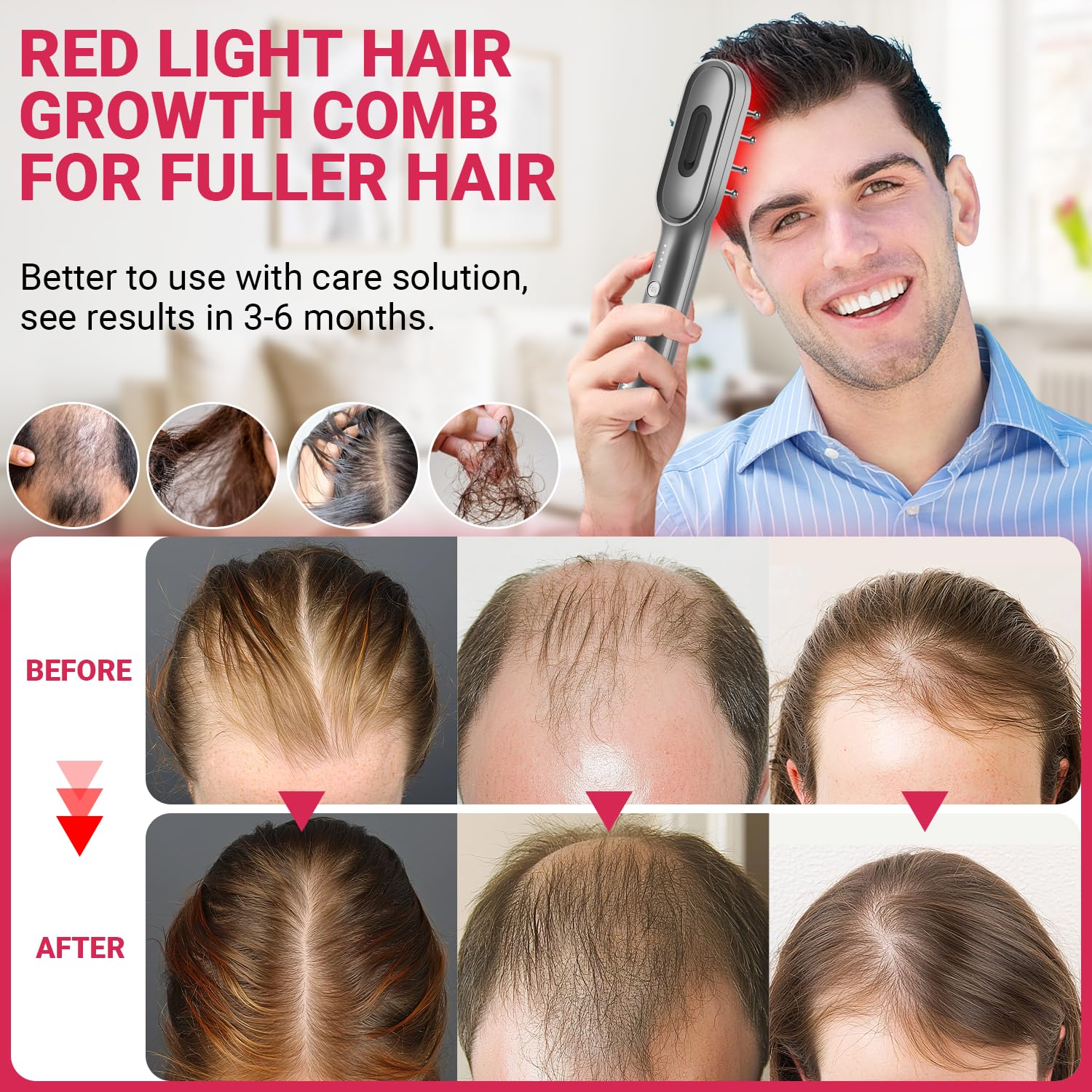 RRZIOM Laser Therapy Hair Growth Comb - Red Light Therapy Comb for Hair Loss Treatment & Regrowth - Alopecia & Scalp Care for Men & Women - At-Home Hair Restoration Solution for Thicker, Healthier Hair