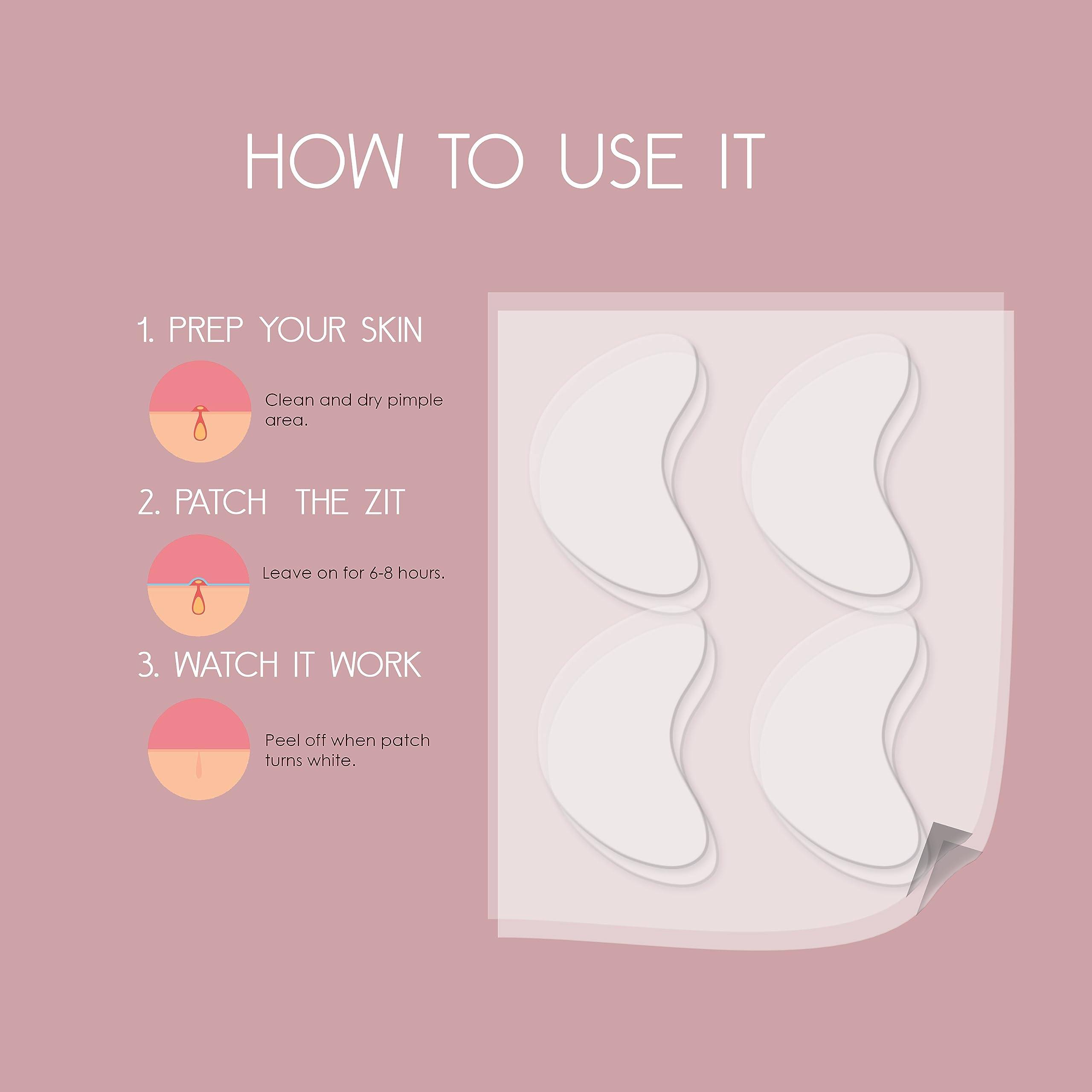 Hydrocolloid Acne Patches for Face - Vegan & Cruelty-Free Pimple Patches (20 Count) - Carbonfree Blemish Cover for Zits, Breakouts & Acne - Perfect for Overnight Spot Treatment & Daily Skincare Routine