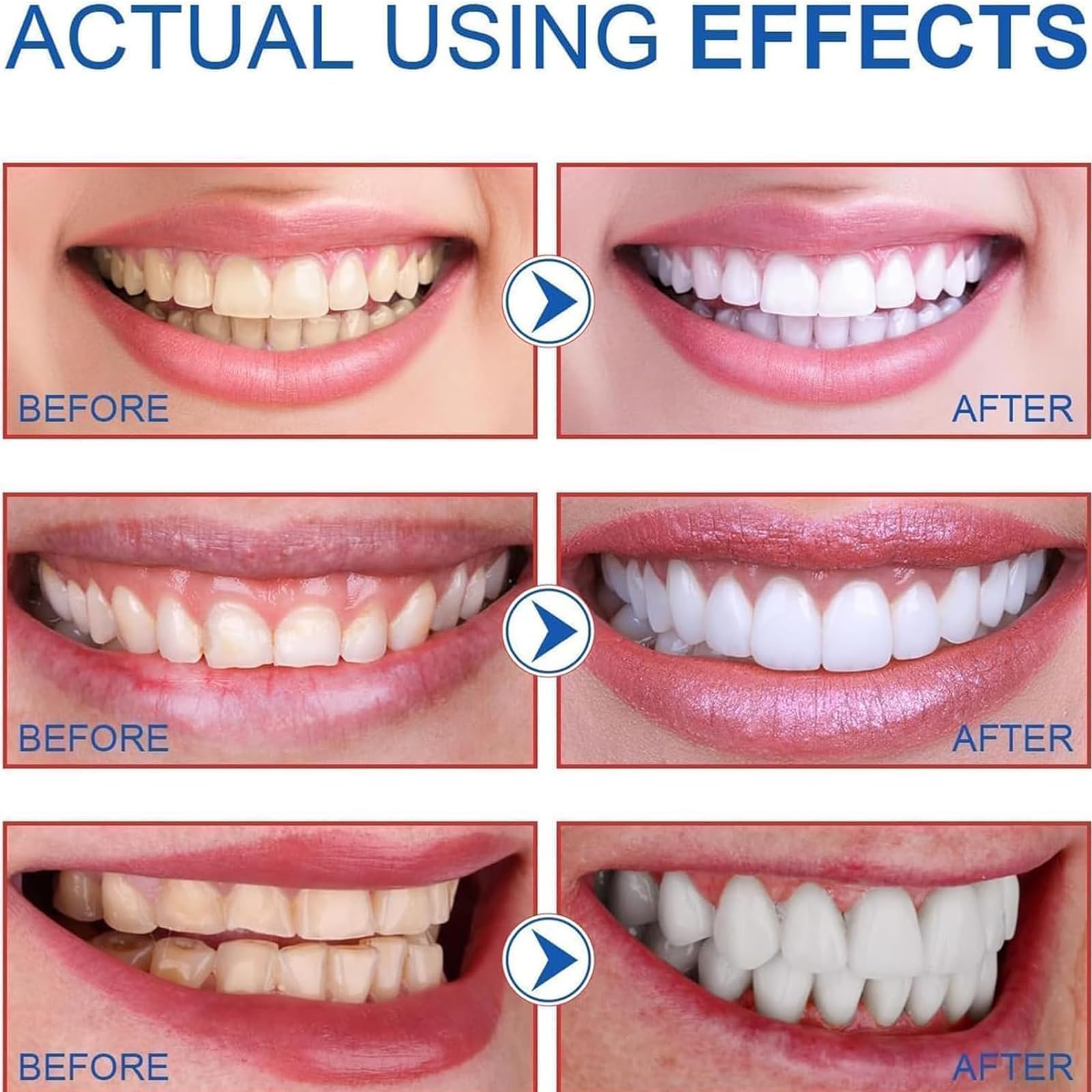 Peakru Baking Soda Toothpaste for Teeth Whitening & Fresh Breath - Natural Oral Care with Sodium Bicarbonate - Whitening Toothpaste for Daily Use at Home & Travel (1 Pack)