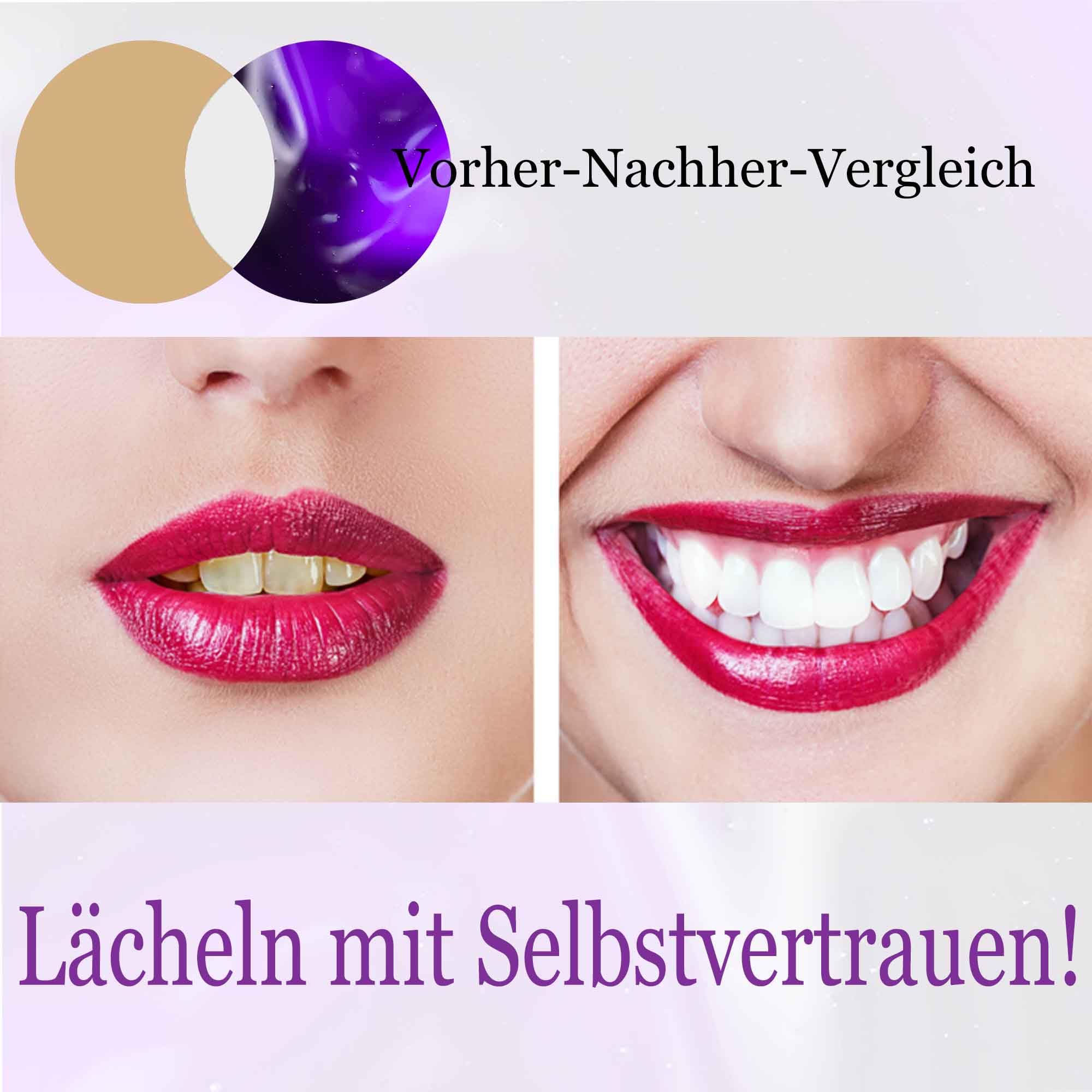 Purple Teeth Whitening Toothpaste - Natural Stain Remover for Yellow Teeth | Brighten Smile, Fresh Breath | Perfect for Daily Oral Care & Coffee/Wine Stain Removal