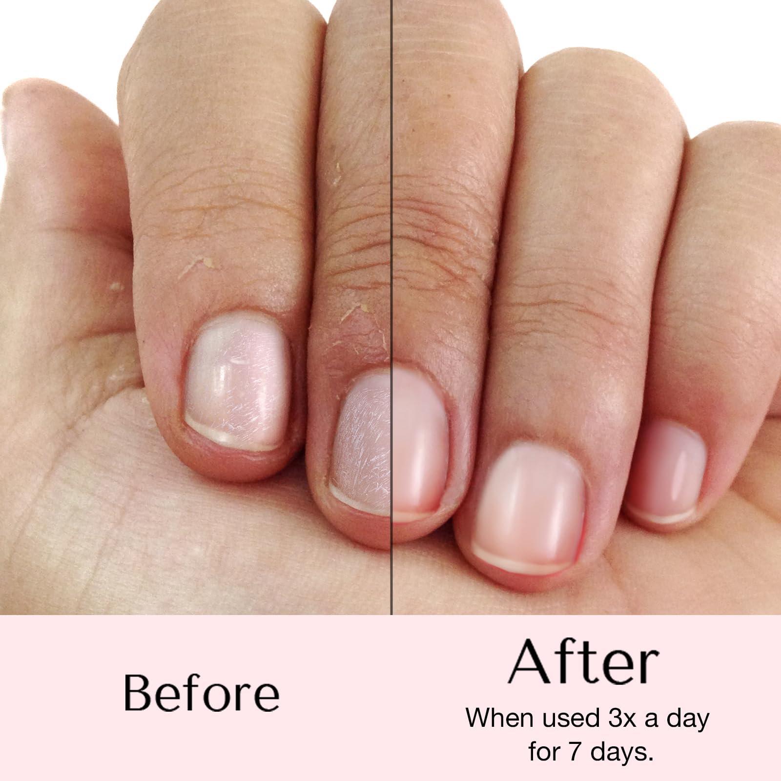 AZUREBEAUTY Nail Strengthener & Growth Serum - Repair Treatment for Thin, Damaged Nails | Manicure Prep & Nail Care Solution | Perfect for Weak, Brittle Nails at Home or Salon