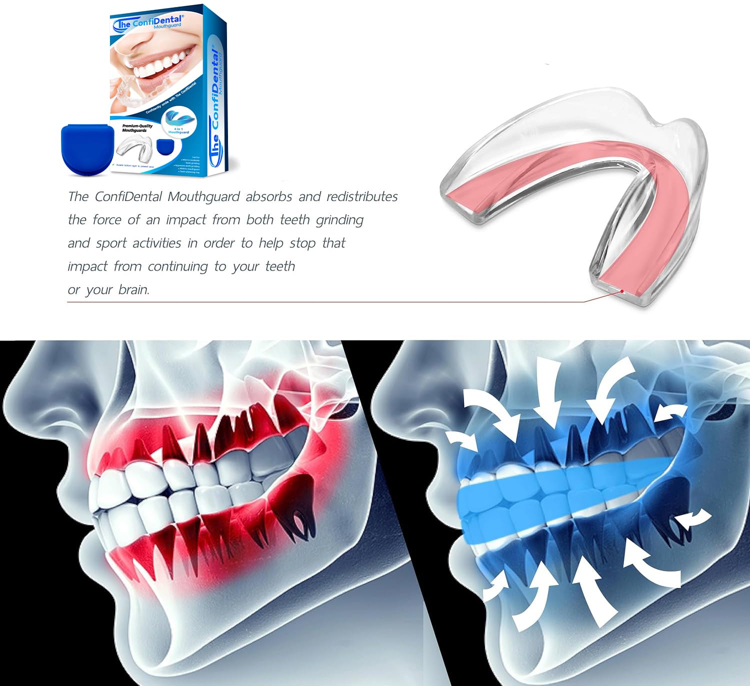 3 Pack Moldable Mouth Guard for Teeth Grinding & Clenching - Bruxism Night Guard, Sports Mouthguard & Teeth Whitening Tray - Includes 2 Regular & 1 Heavy Duty Guards (LLL & II) - Perfect for Sleeping, Boxing, MMA & Dental Care