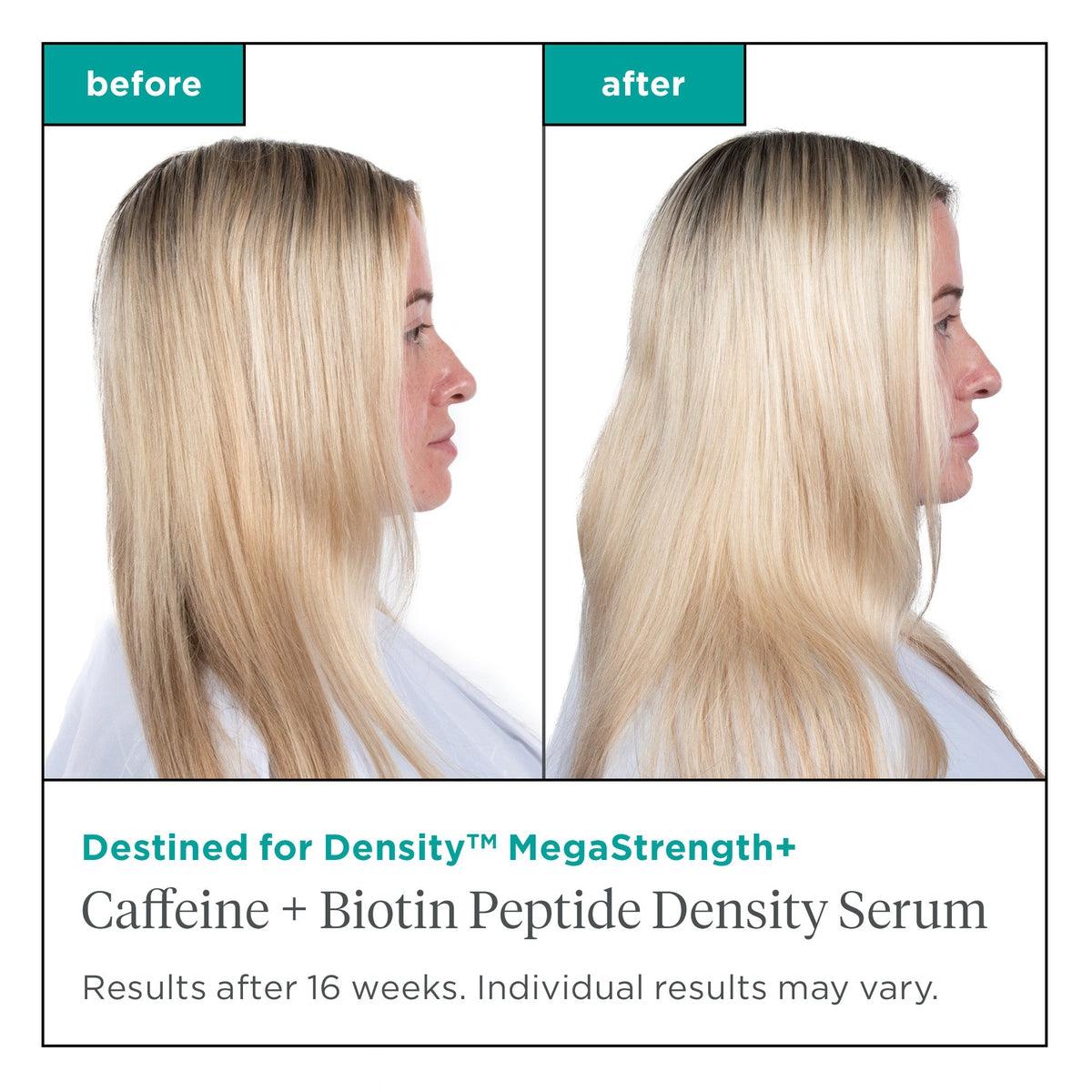 Destined For Density Megastrength+ Caffeine & Biotin Peptide Hair Growth Serum - Thickening Treatment for Thinning Hair | Promotes Fuller, Healthier Locks | Daily Use for Men & Women