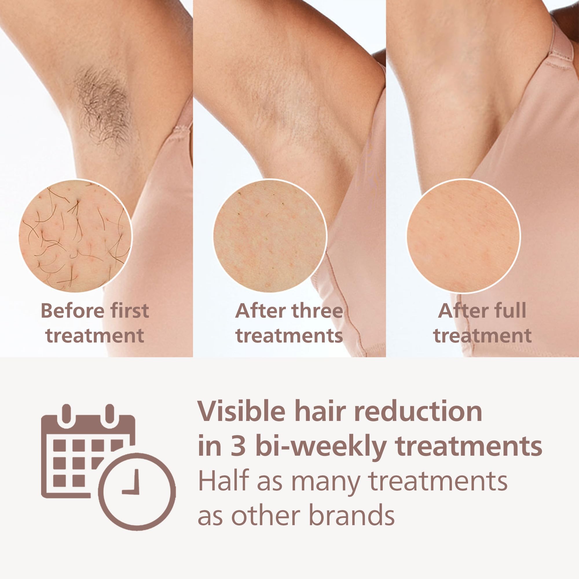 Philips Lumea IPL Hair Removal 8000 Series - Permanent Hair Removal Device with SenseIQ Technology for Women & Men, 2 Attachments for Body & Face, Corded Use (Model BRI944/00) - At-Home Hair Removal Solution for Smooth Skin