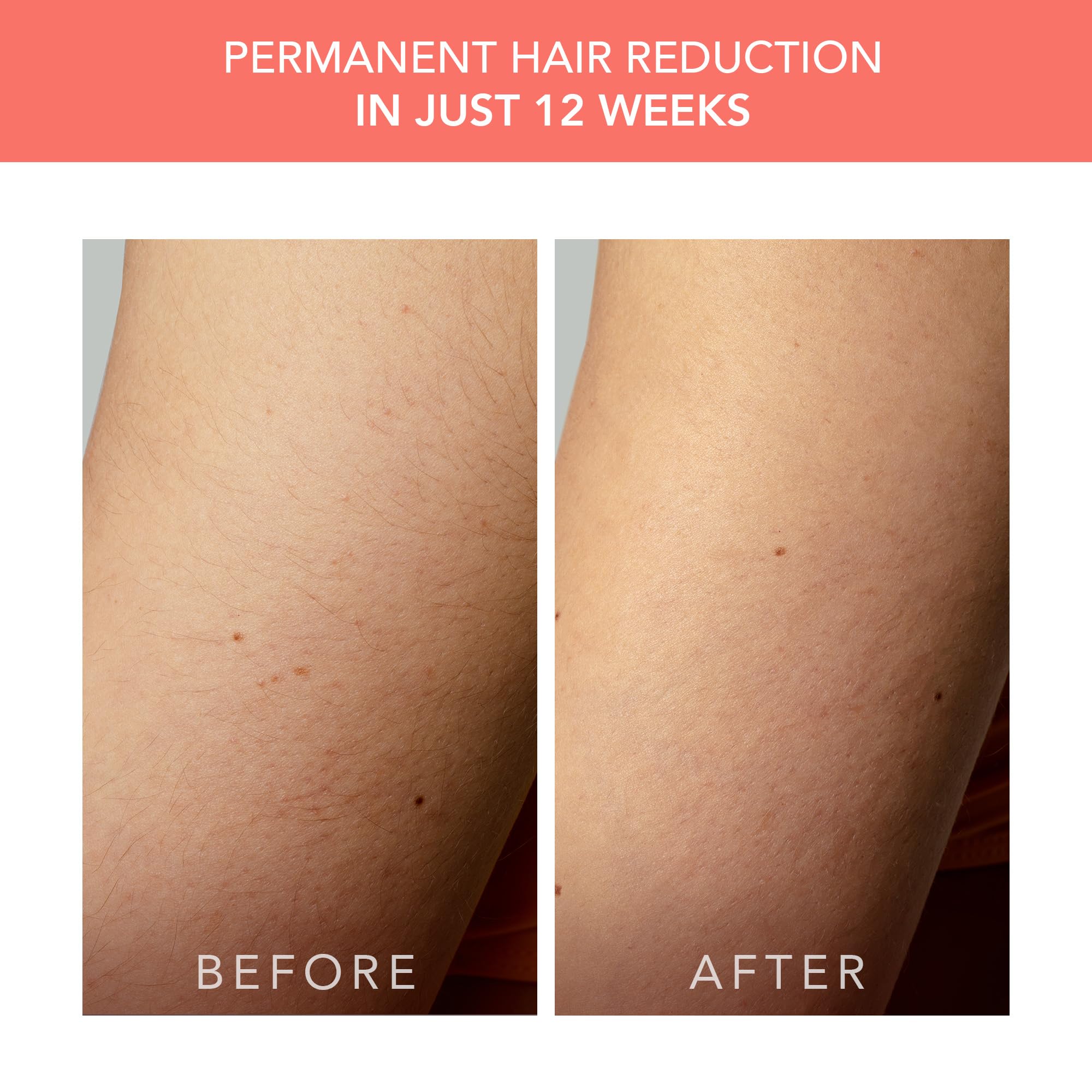 FOREO Peach 2 Go IPL Hair Removal Device - Permanent Painless Hair Removal for Face & Body - Travel-Friendly Laser Hair Removal with Skin Cooling & Silicone Shield - Customizable Settings - Coral | At-Home Hair Removal for Smooth Skin - Perfect for Travel, Gym & Beach Prep