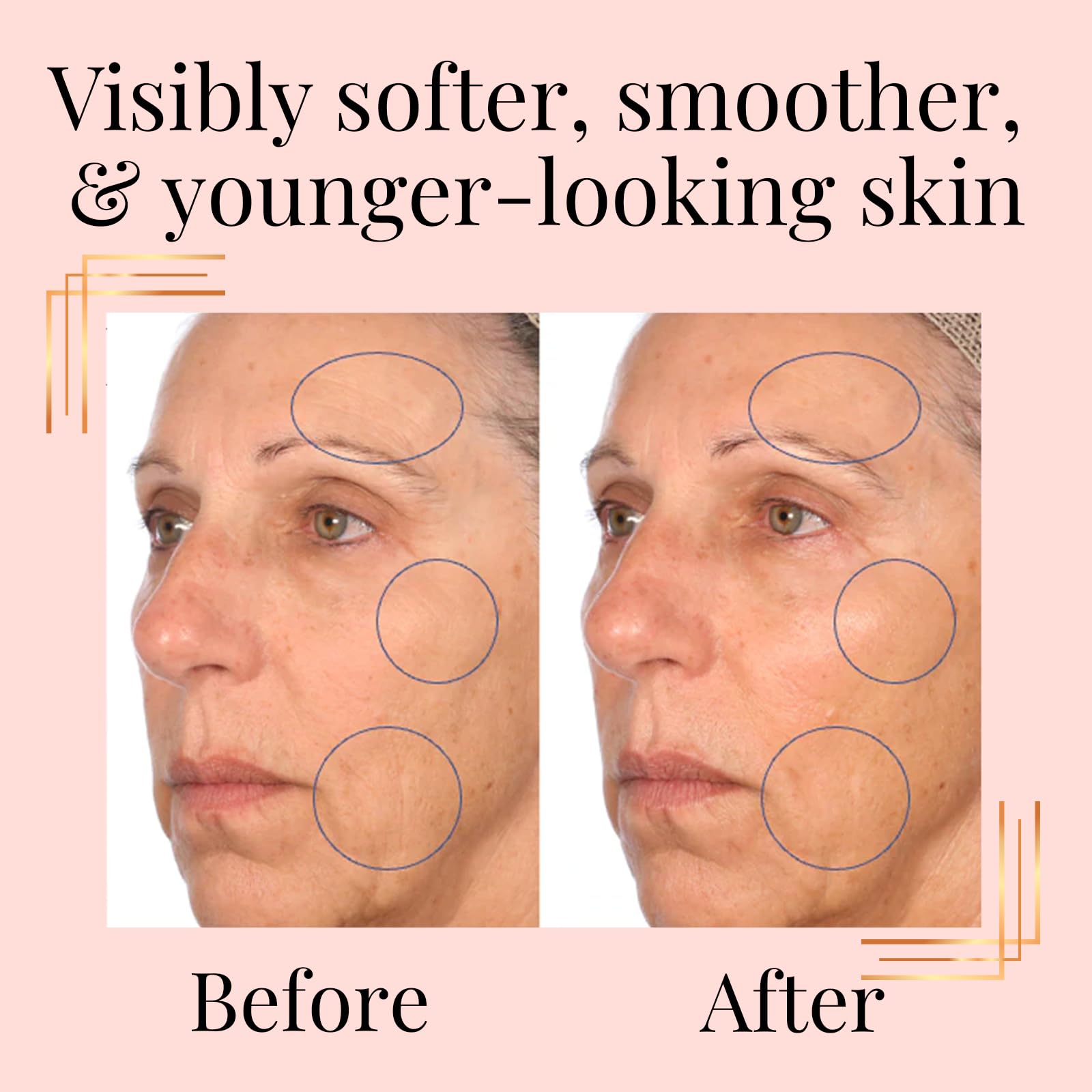SkinInfusion Anti-Aging Collagen Serum with Hyaluronic Acid & Vitamin C - Hydrating Facial Oil for Dark Spots, Dullness & Dry Skin - Matrixyl 3000 Moisturizing Serum - 150ml | Daily Skincare Routine & Night Treatment for Glowing Complexion