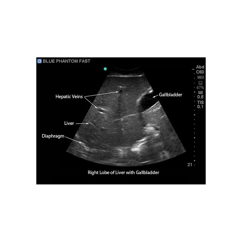 FAST Exam Ultrasound Training Model - Transthoracic & Transesophageal Echo Simulator for Cardiac Sonography Practice (Ideal for Medical Students, Ultrasound Tech Training & Clinical Skills Development)