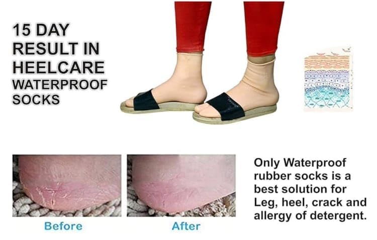 **Waterproof Rubber Socks for Men & Women – Anti-Crack Gel Heel, Moisturizing Foot Care Socks for Pain Relief & Dry Skin (1 Pair, Skin Brown, Medium) – Ideal for Hiking, Swimming & Indoor Foot Therapy**